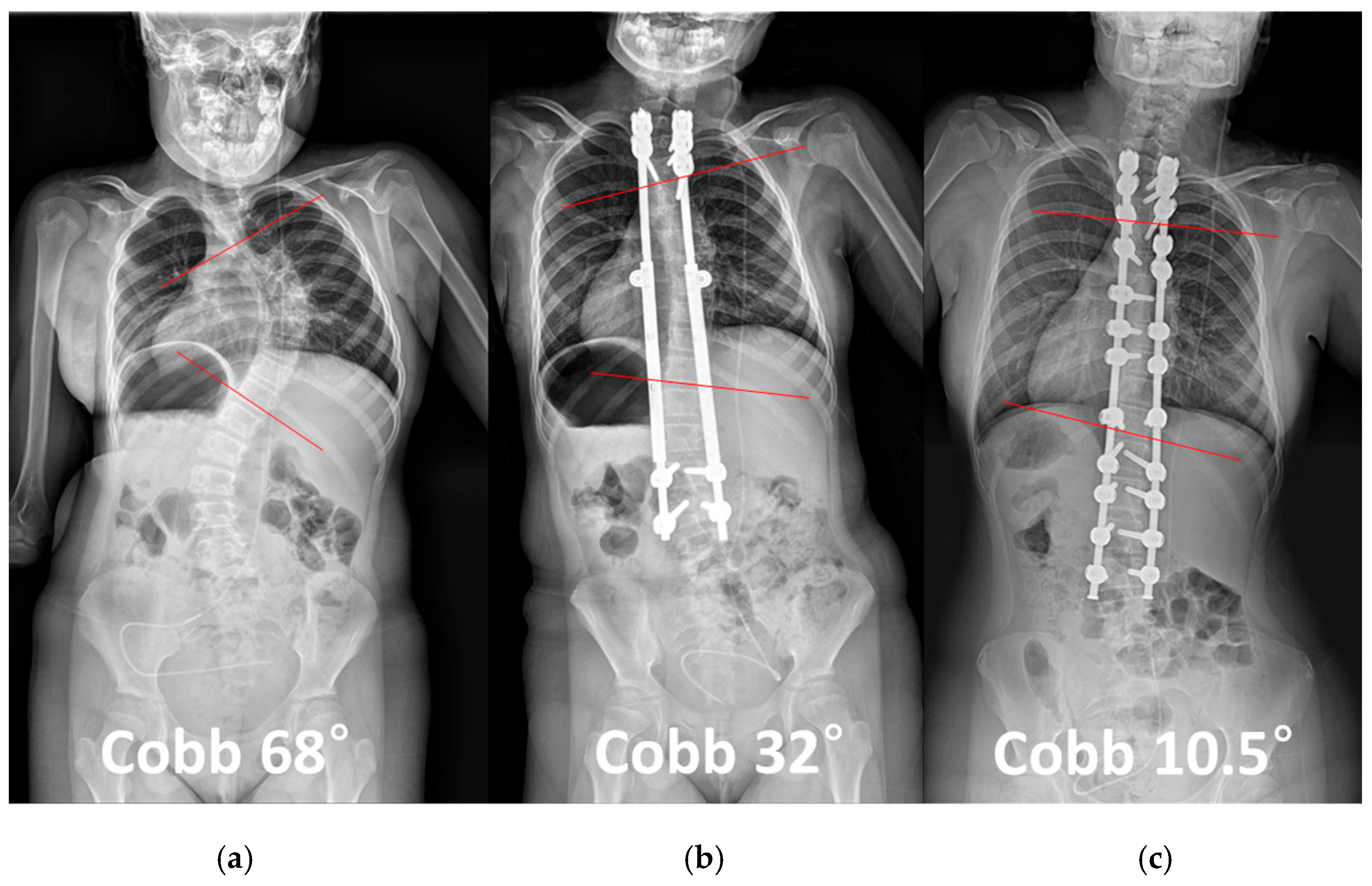 Jcm 14 07184 g001 Jcm 14 07184 g001