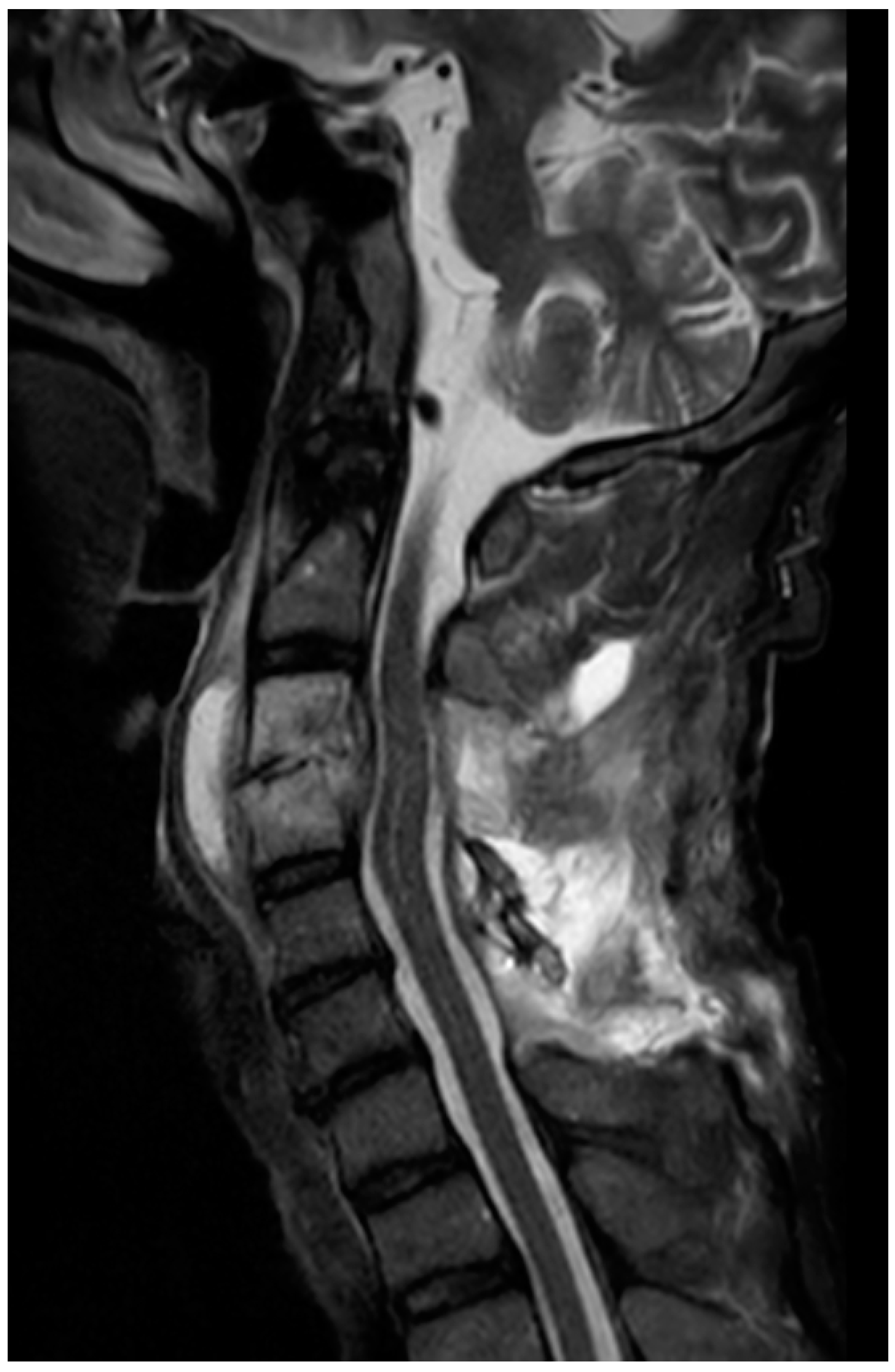 Jcm 14 07346 g003 Jcm 14 07346 g003