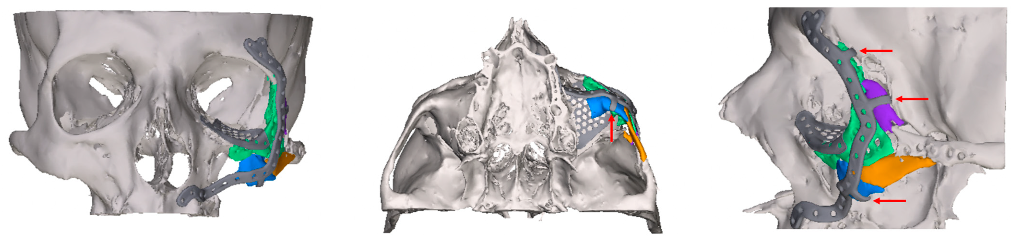 Jcm 14 07439 g001 Jcm 14 07439 g001