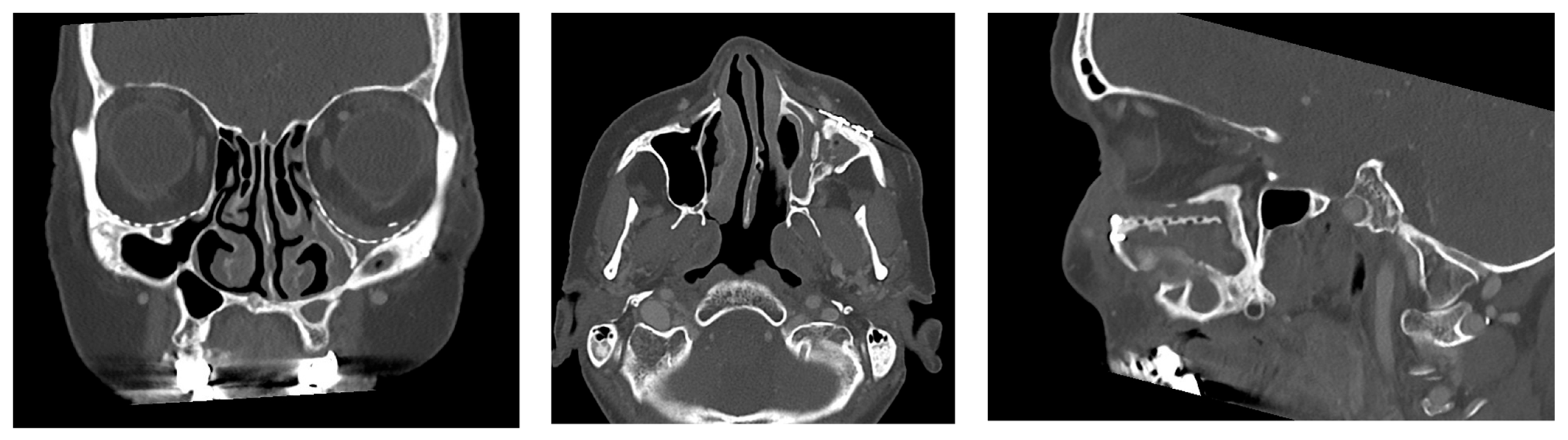 Jcm 14 07439 g002 Jcm 14 07439 g002