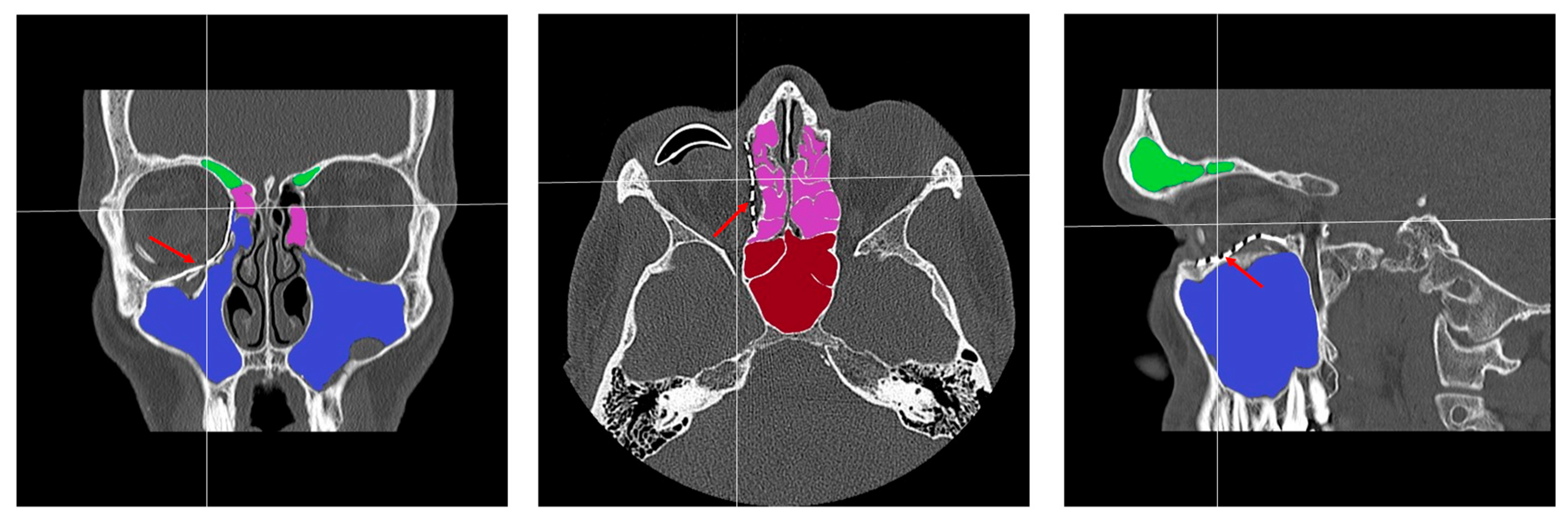 Jcm 14 07439 g003 Jcm 14 07439 g003