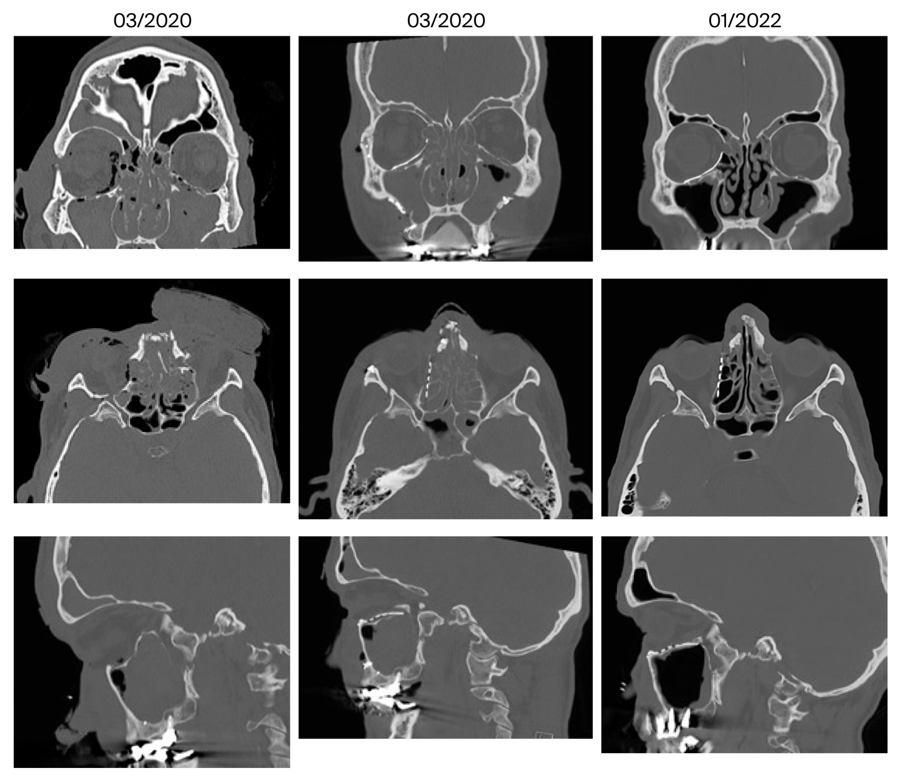 Jcm 14 07439 g007 Jcm 14 07439 g007