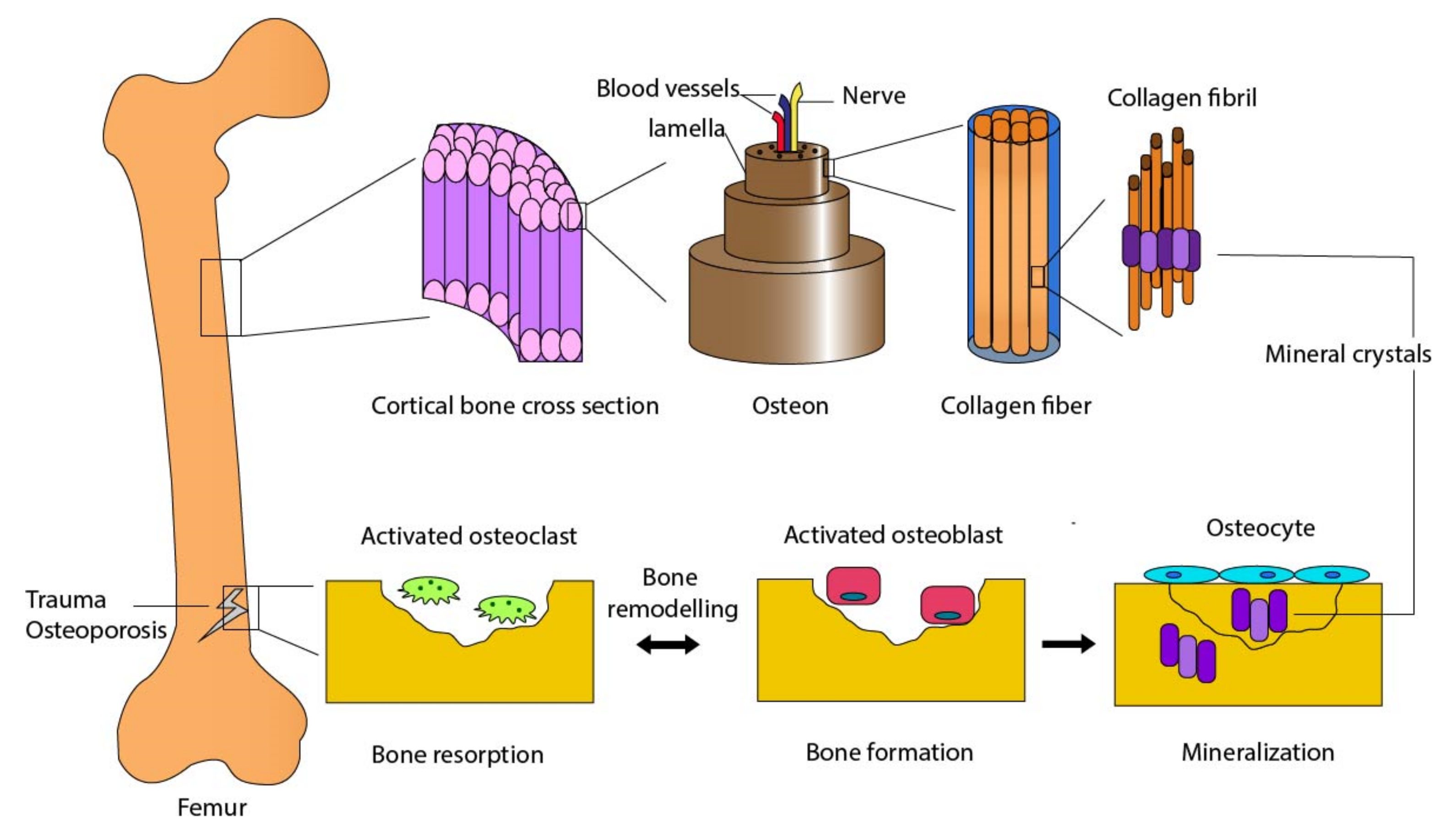 J. Compos. Sci. | Free Full-Text | Toughening of Bioceramic Composites for  Bone Regeneration