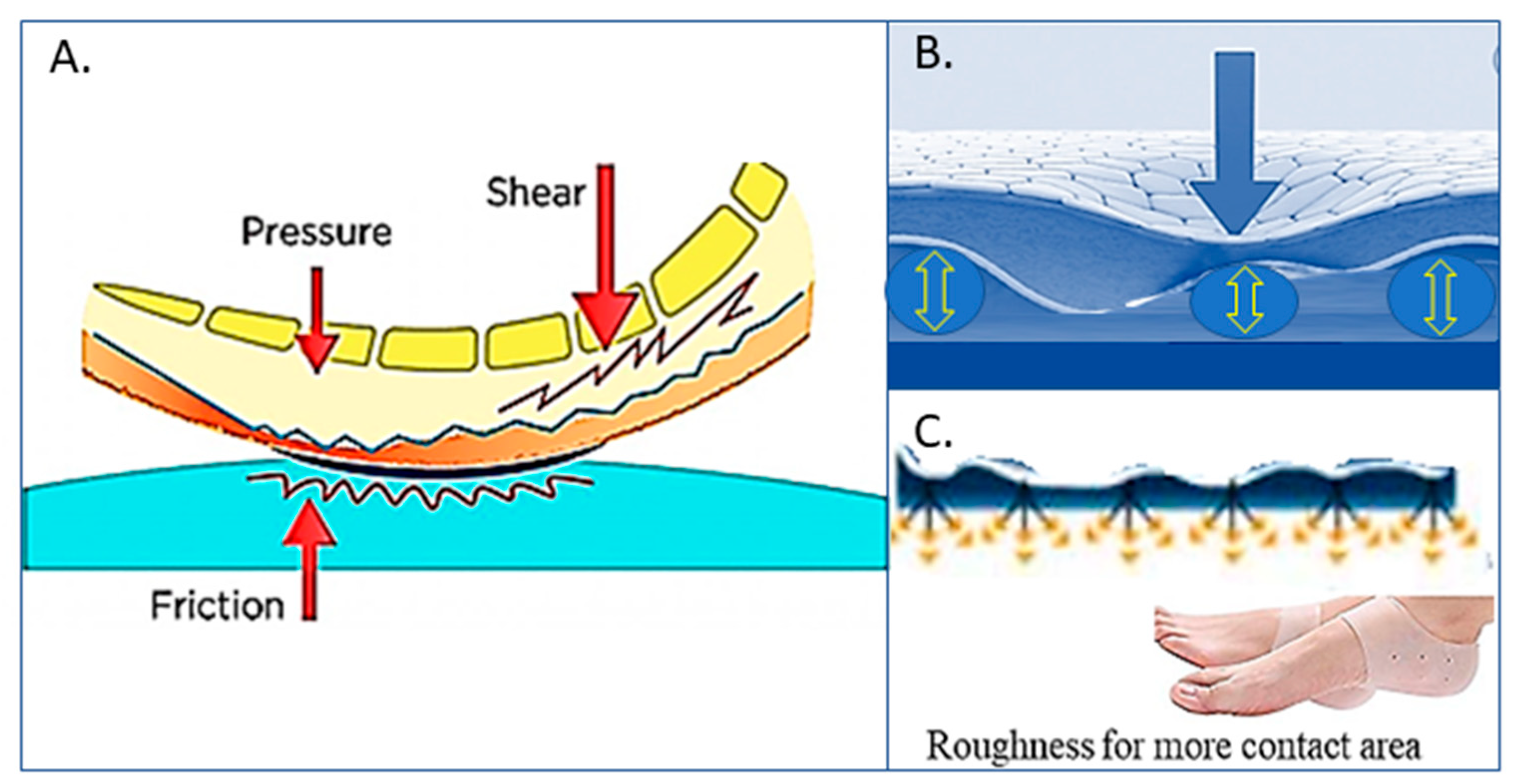 Smart-e-Pants for preventing pressure ulcers: A stimulating idea - Hospital  News