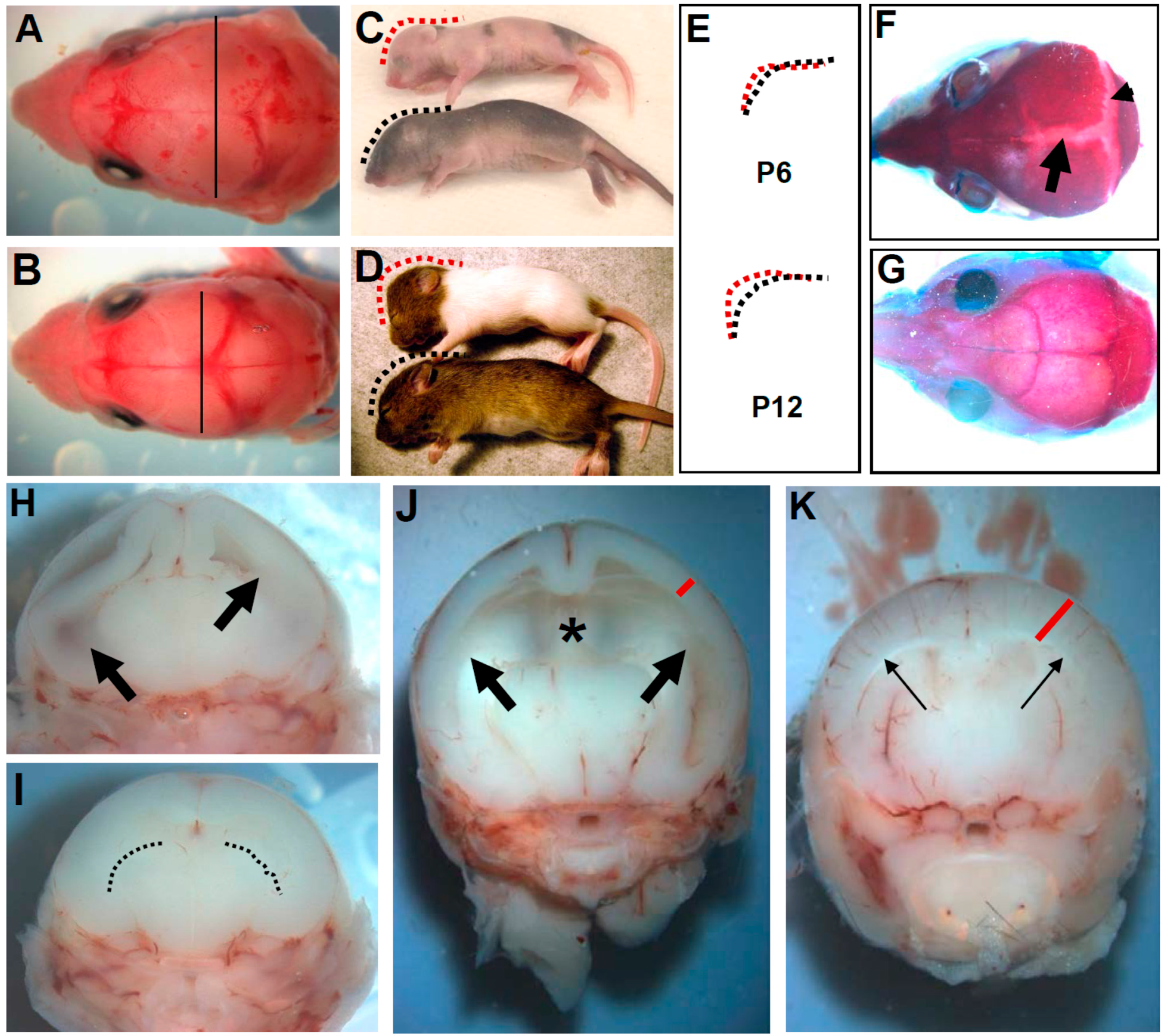 Frontiers  Pax3/7 regulates neural tube closure and patterning in