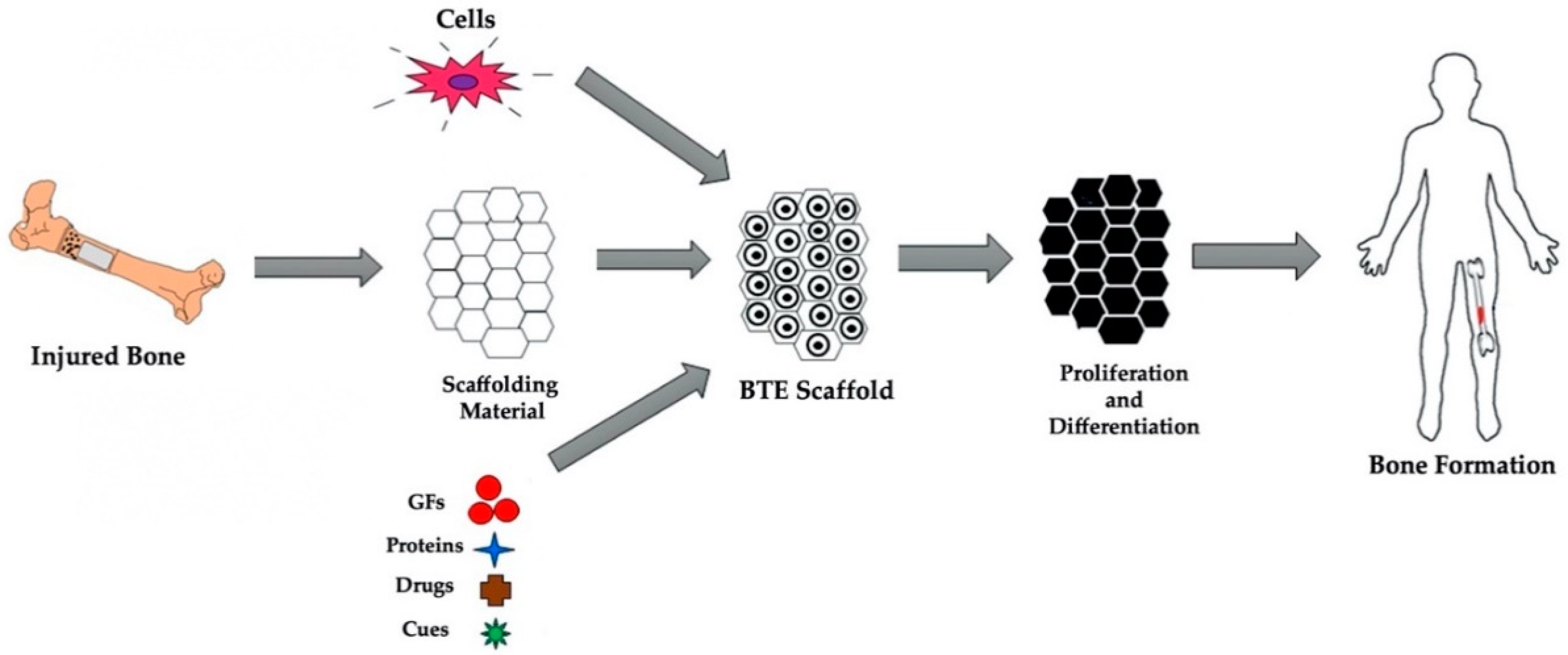 JFB | Free Full-Text | Conductive Scaffolds for Bone Tissue Engineering:  Current State and Future Outlook