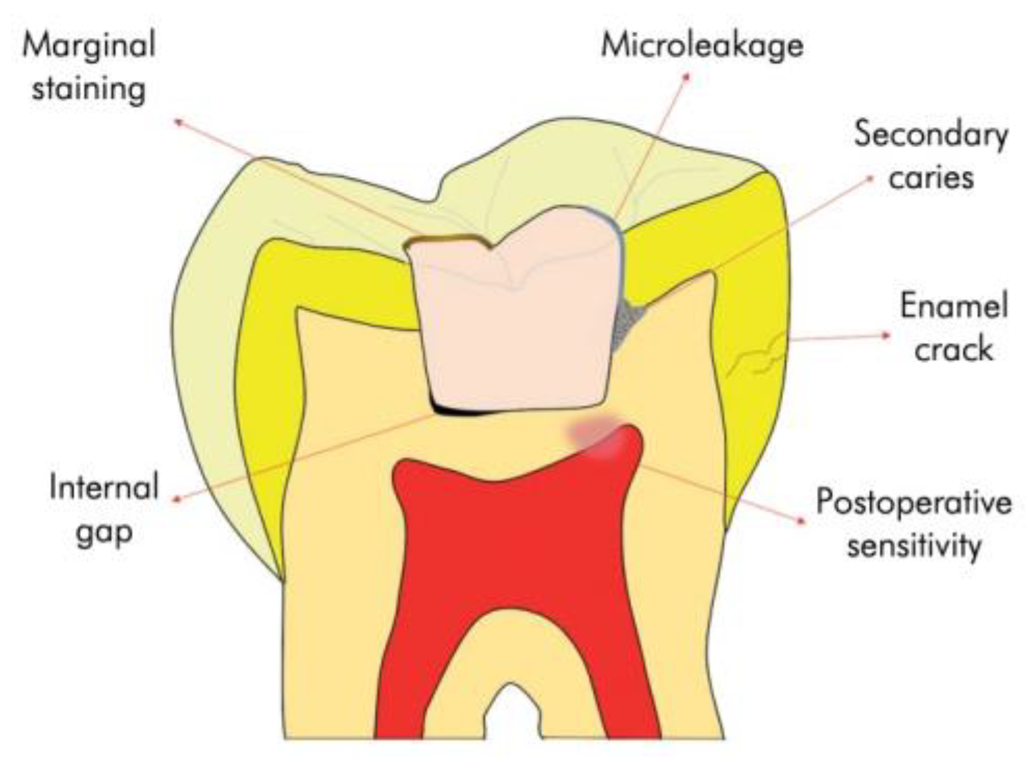 JFB | Free Full-Text | A Narrative Review Of Bioactive Glass-Loaded ...