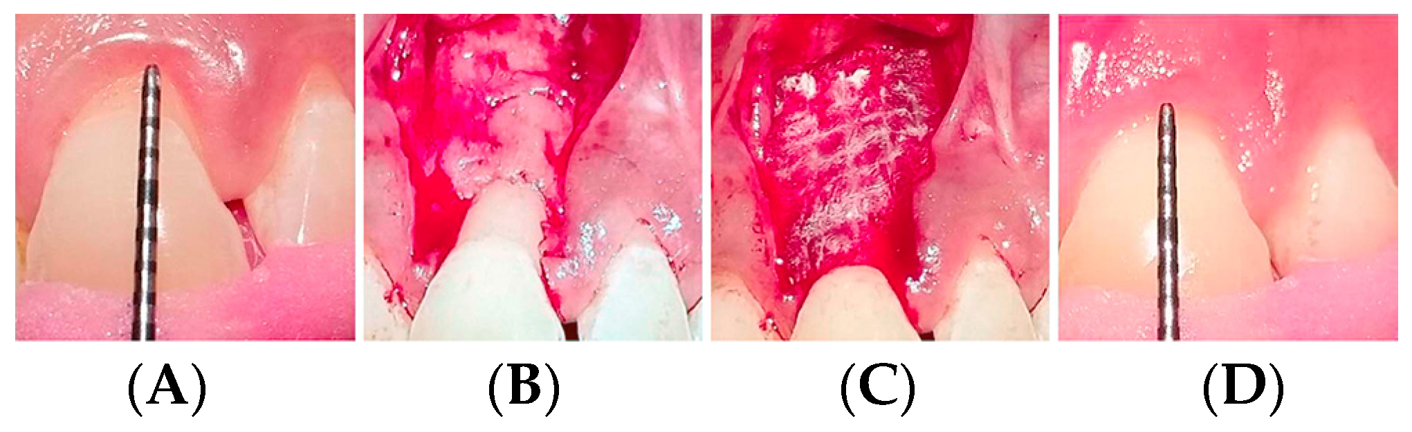 Jfb 14 00531 g004 Jfb 14 00531 g004