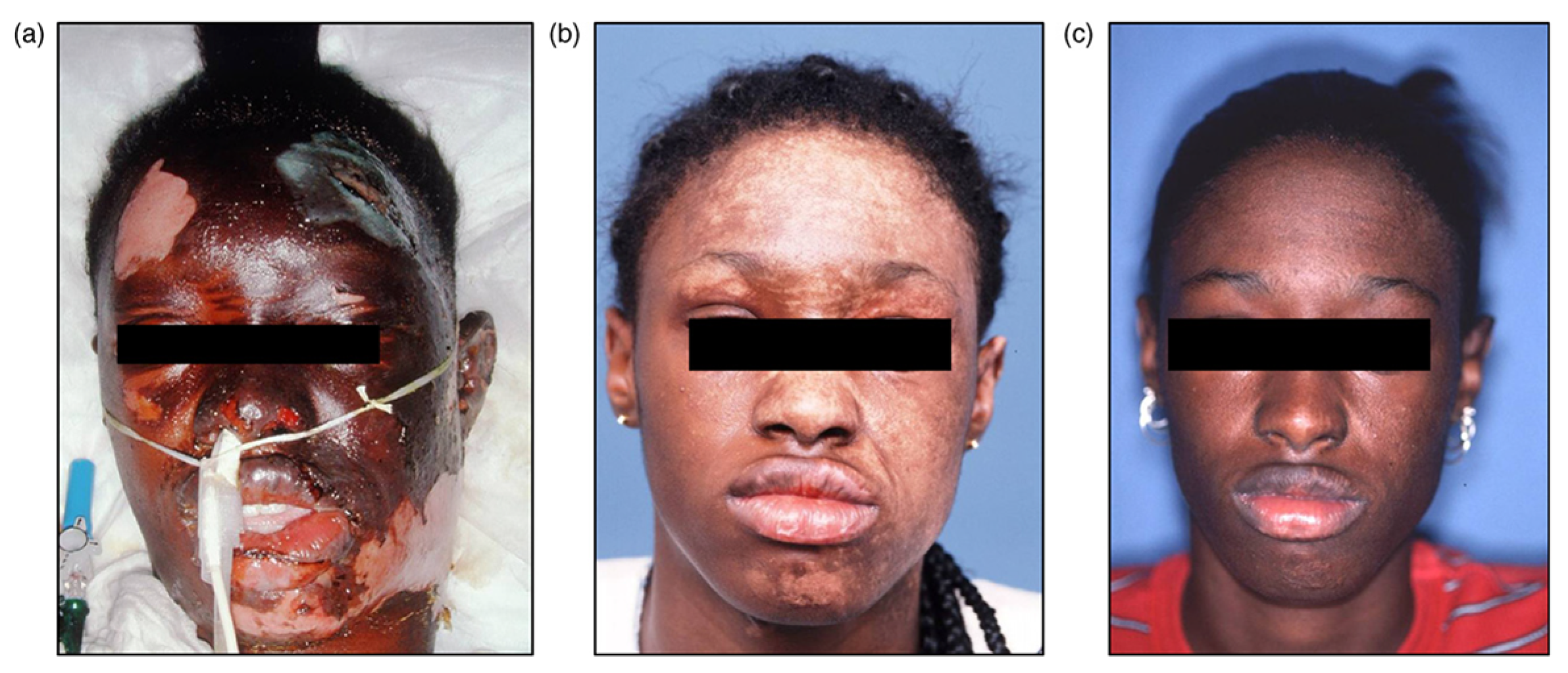 Jfb 14 00531 g007 Jfb 14 00531 g007