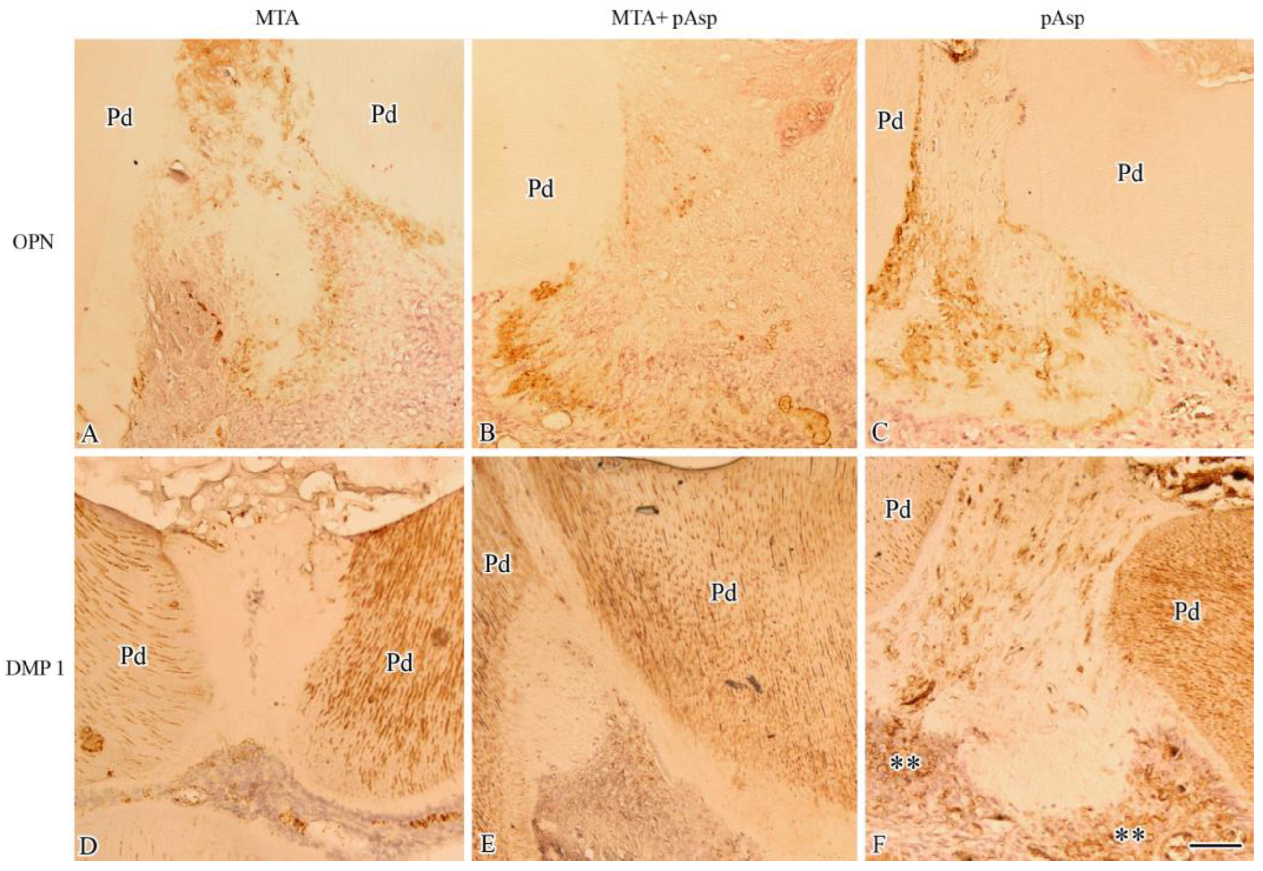 Light micrographs showing several regions of the dentin-pulp interface