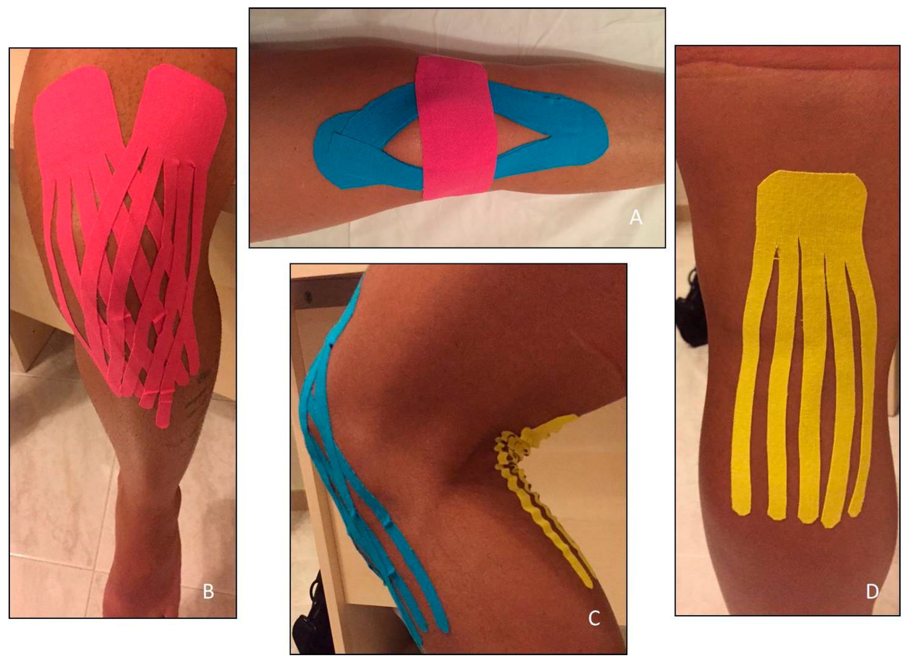 JFMK | Free Full-Text | The Effects of Exercise and Kinesio Tape on  Physical Limitations in Patients with Knee Osteoarthritis | HTML