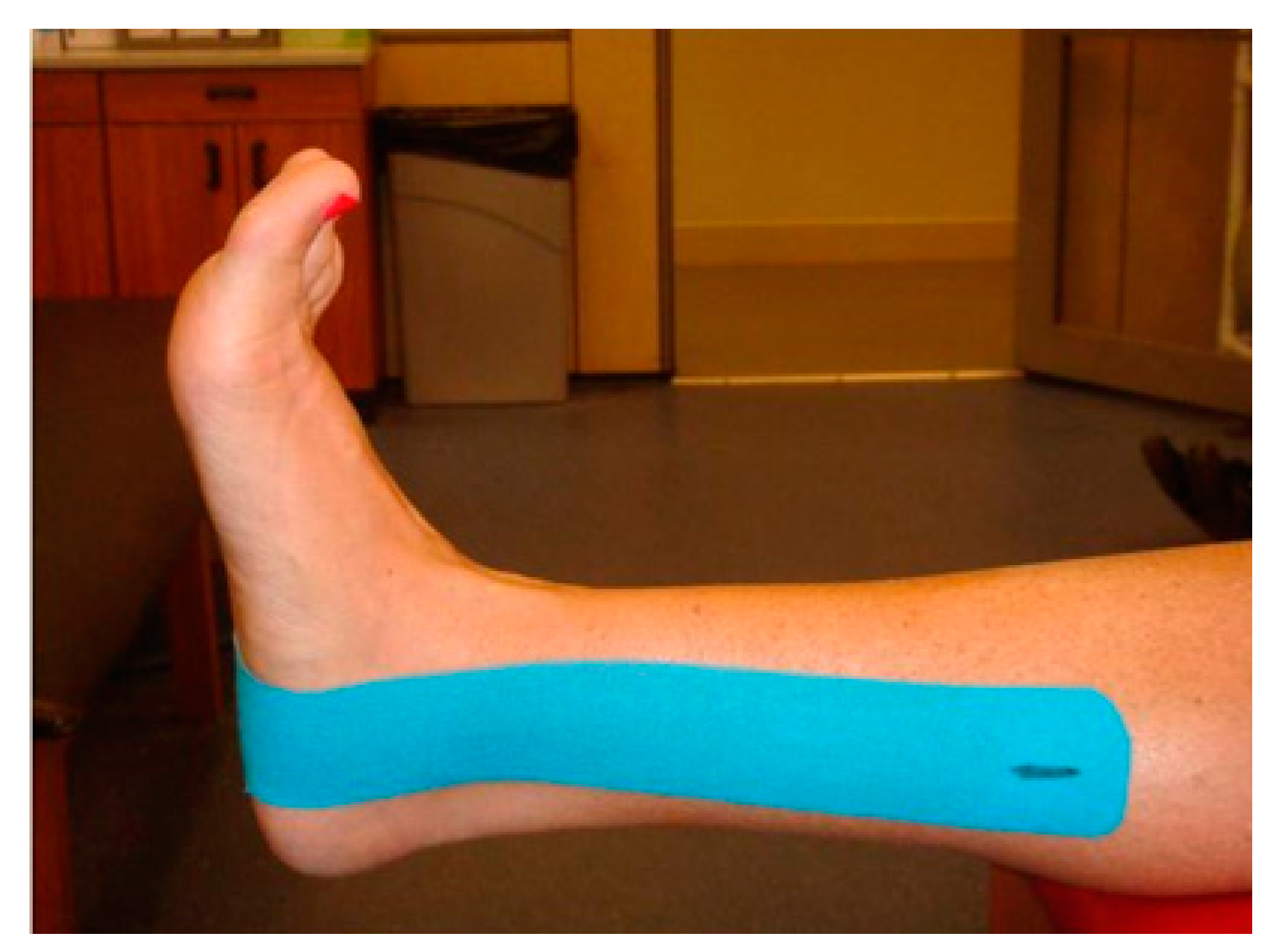 Learn strap taping technique to combat common ankle injuries – Human  Kinetics