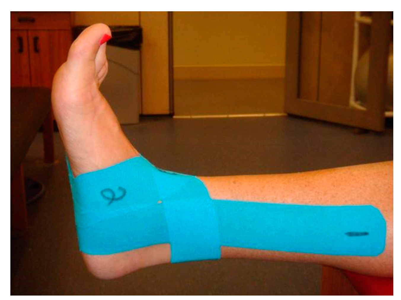 Using Kinesiology taping to stabilise the ankle - does it work
