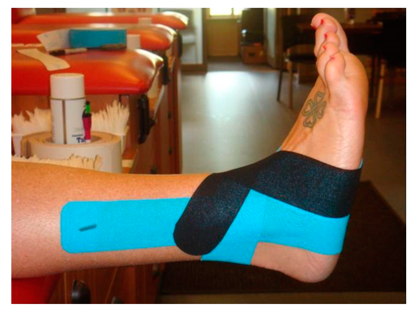 JFMK | Free Full-Text | Effect of Kinesio® Taping on Ankle Complex Motion  and Stiffness and Jump Landing Time to Stabilization in Female Ballet  Dancers