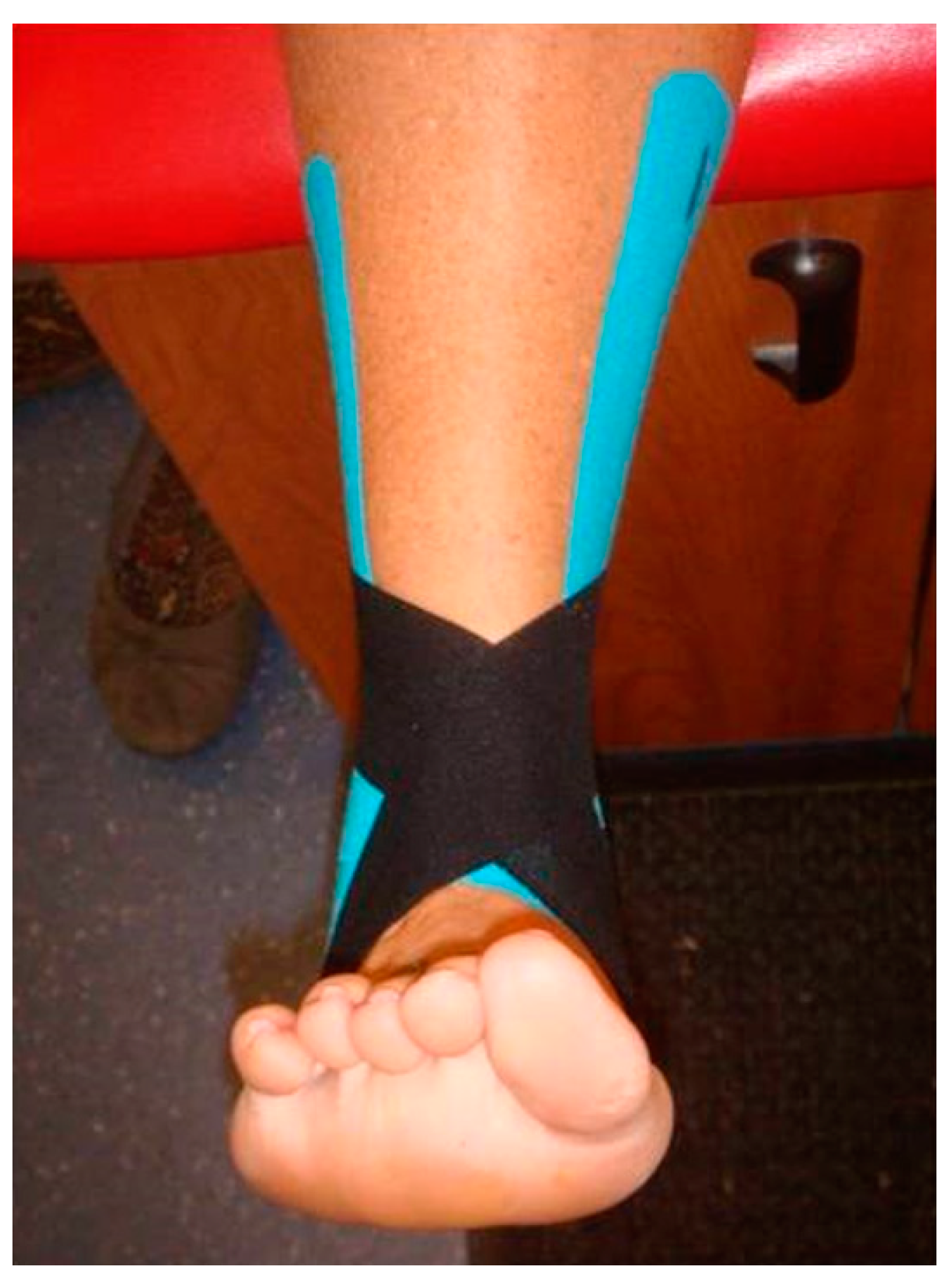 JFMK | Free Full-Text | Effect of Kinesio® Taping on Ankle Complex Motion  and Stiffness and Jump Landing Time to Stabilization in Female Ballet  Dancers