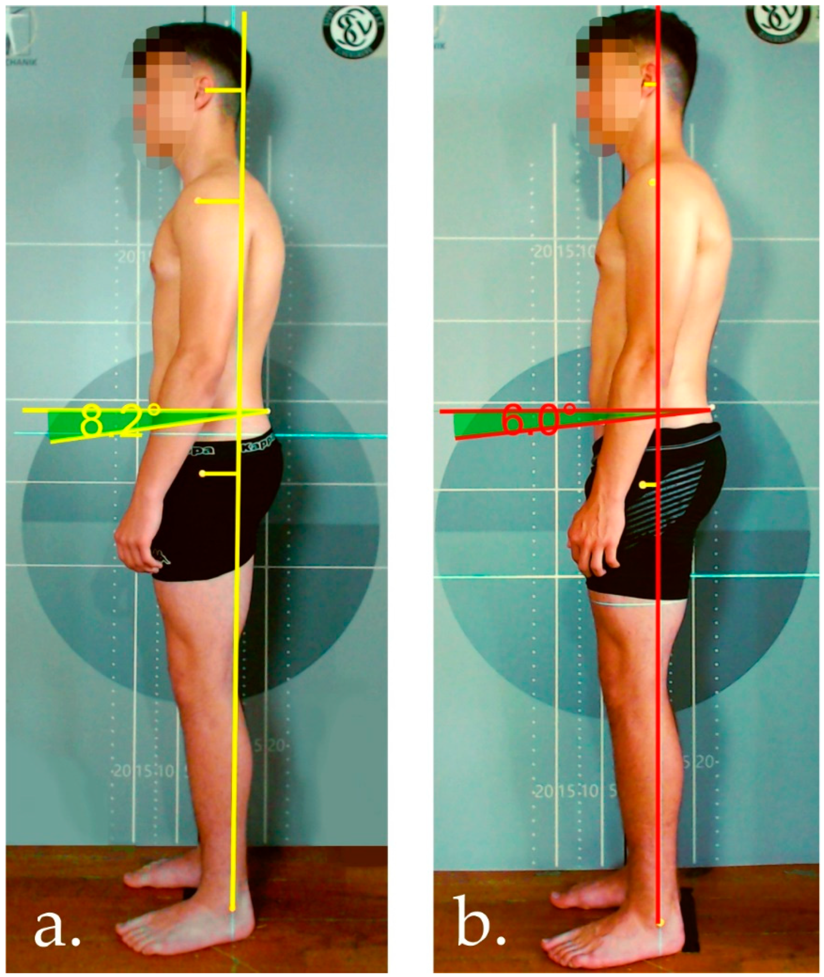 Jfmk 07 00088 g004 Jfmk 07 00088 g004