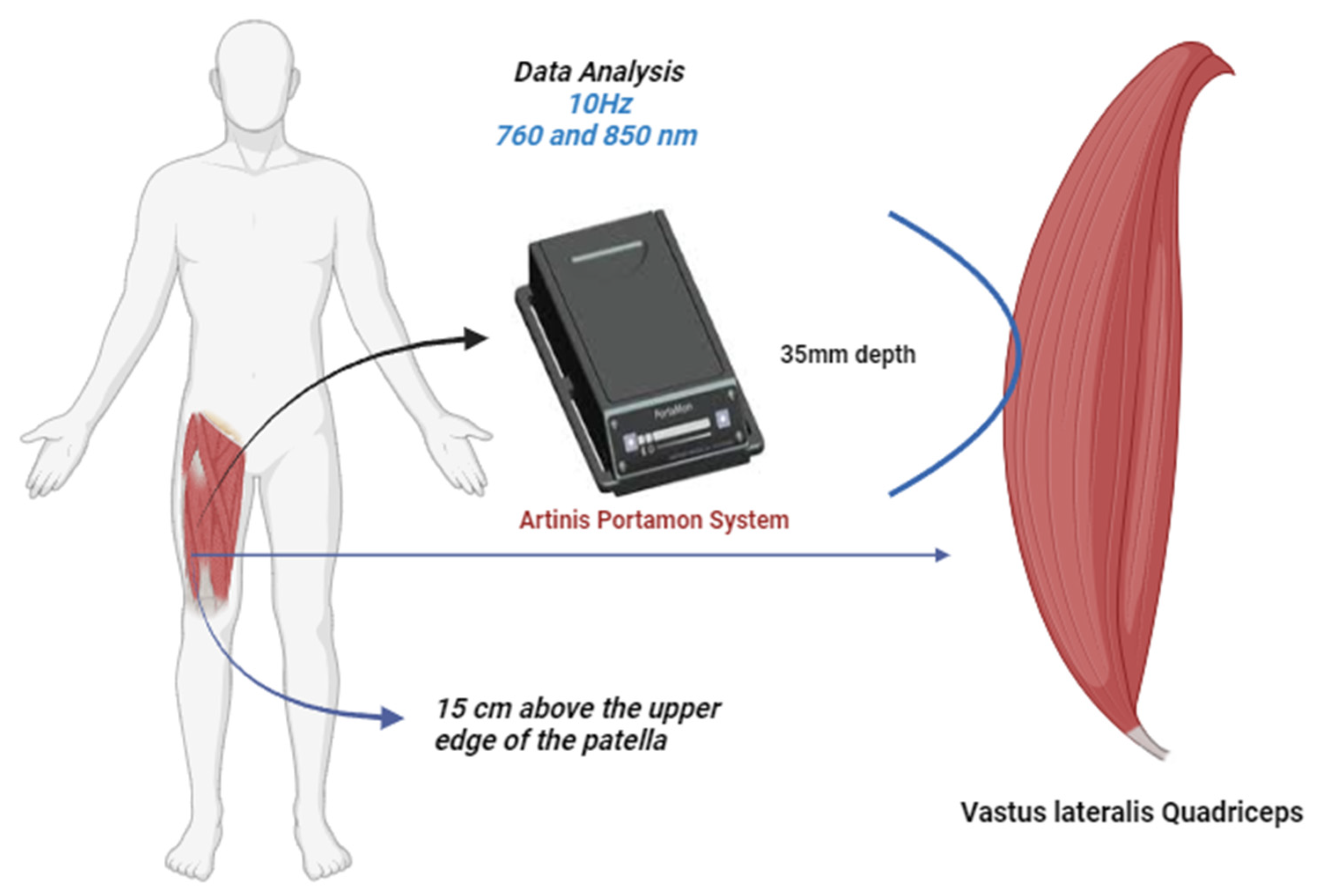 https://www.mdpi.com/jfmk/jfmk-08-00149/article_deploy/html/images/jfmk-08-00149-g001.png