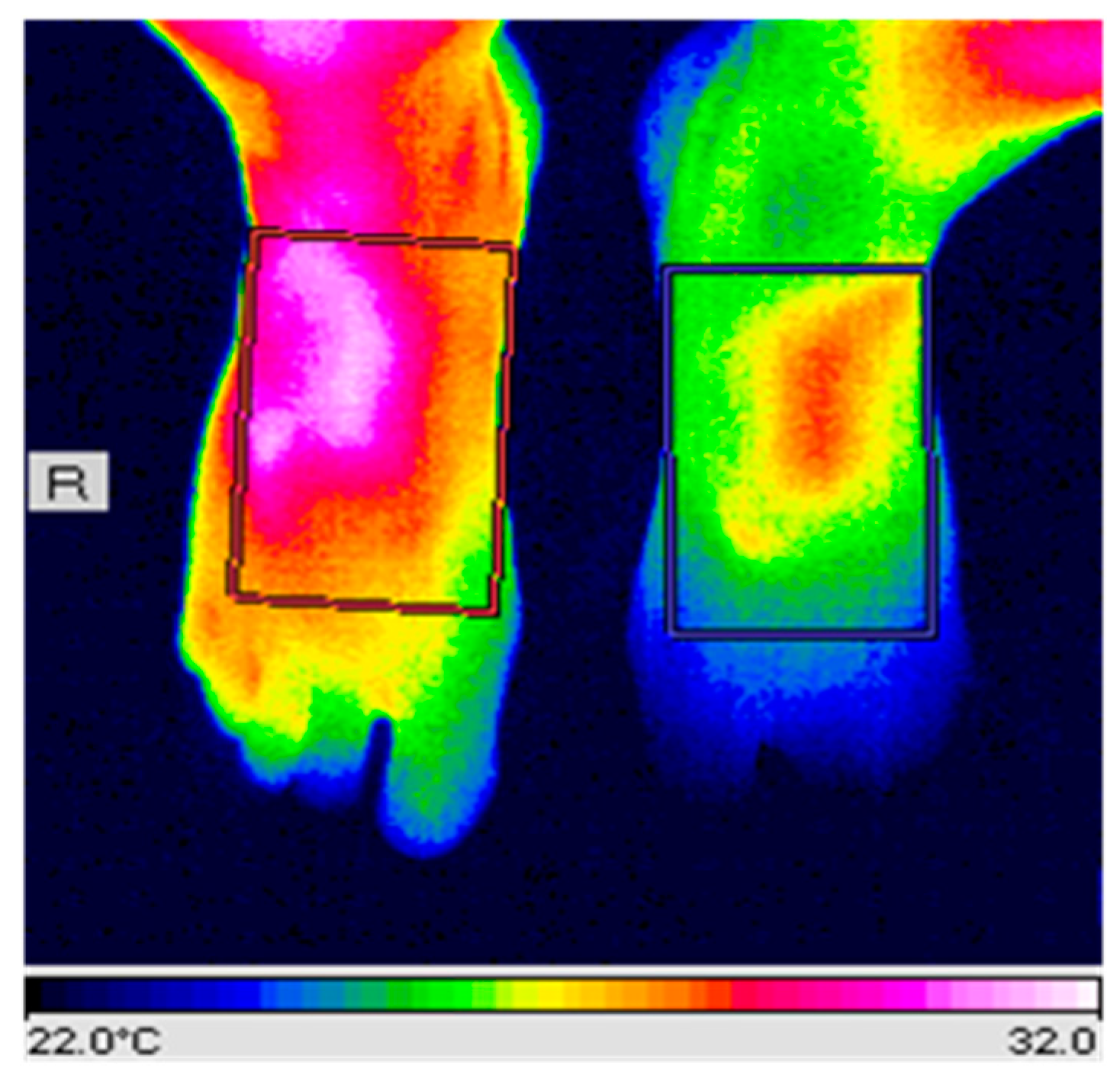 J. Imaging | Free Full-Text | The Herschel Heritage to Medical Thermography  | HTML