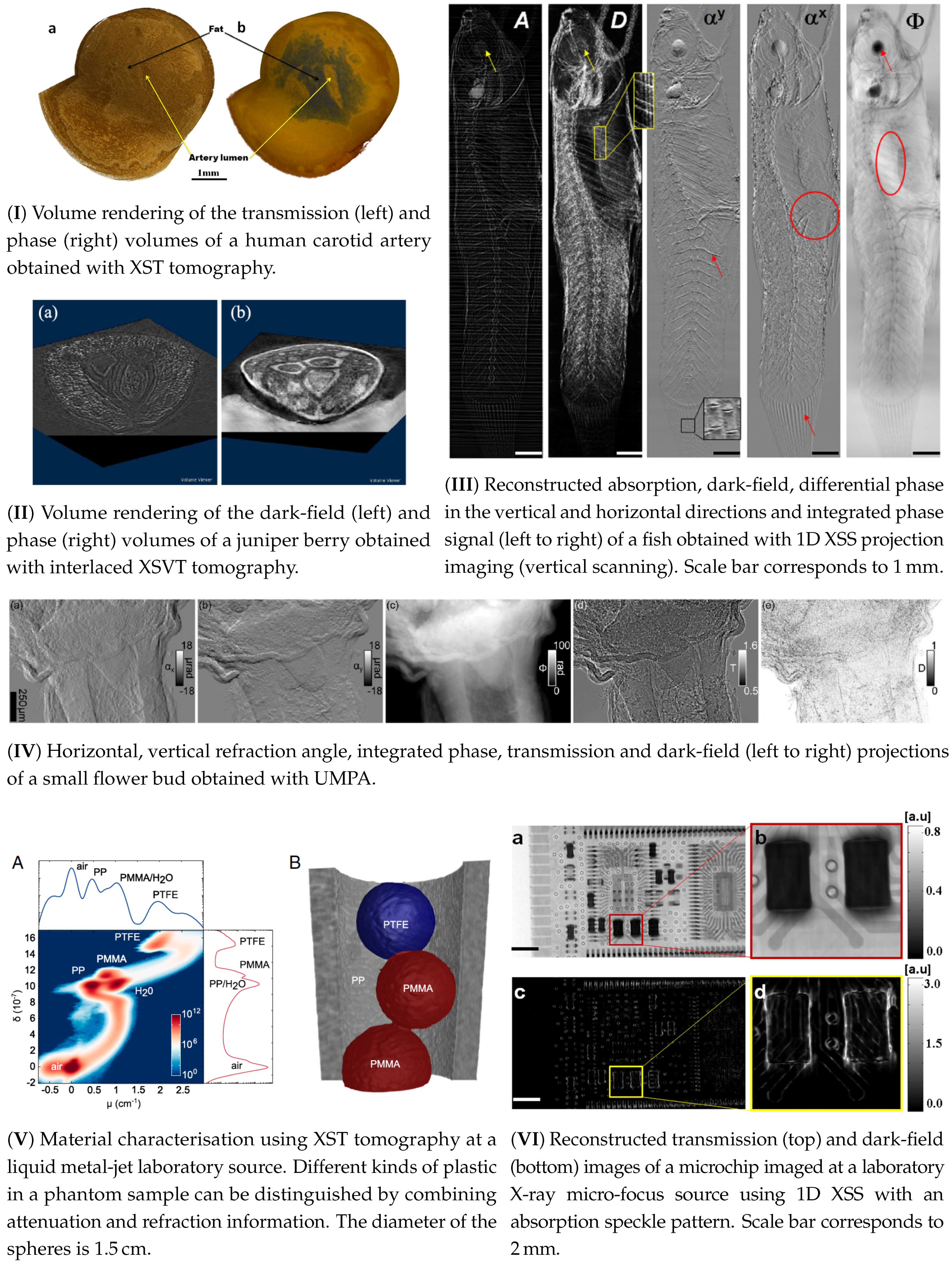 J Imaging Free Full Text State Of The Art Of X Ray Speckle Based Phase Contrast And Dark Field Imaging Html