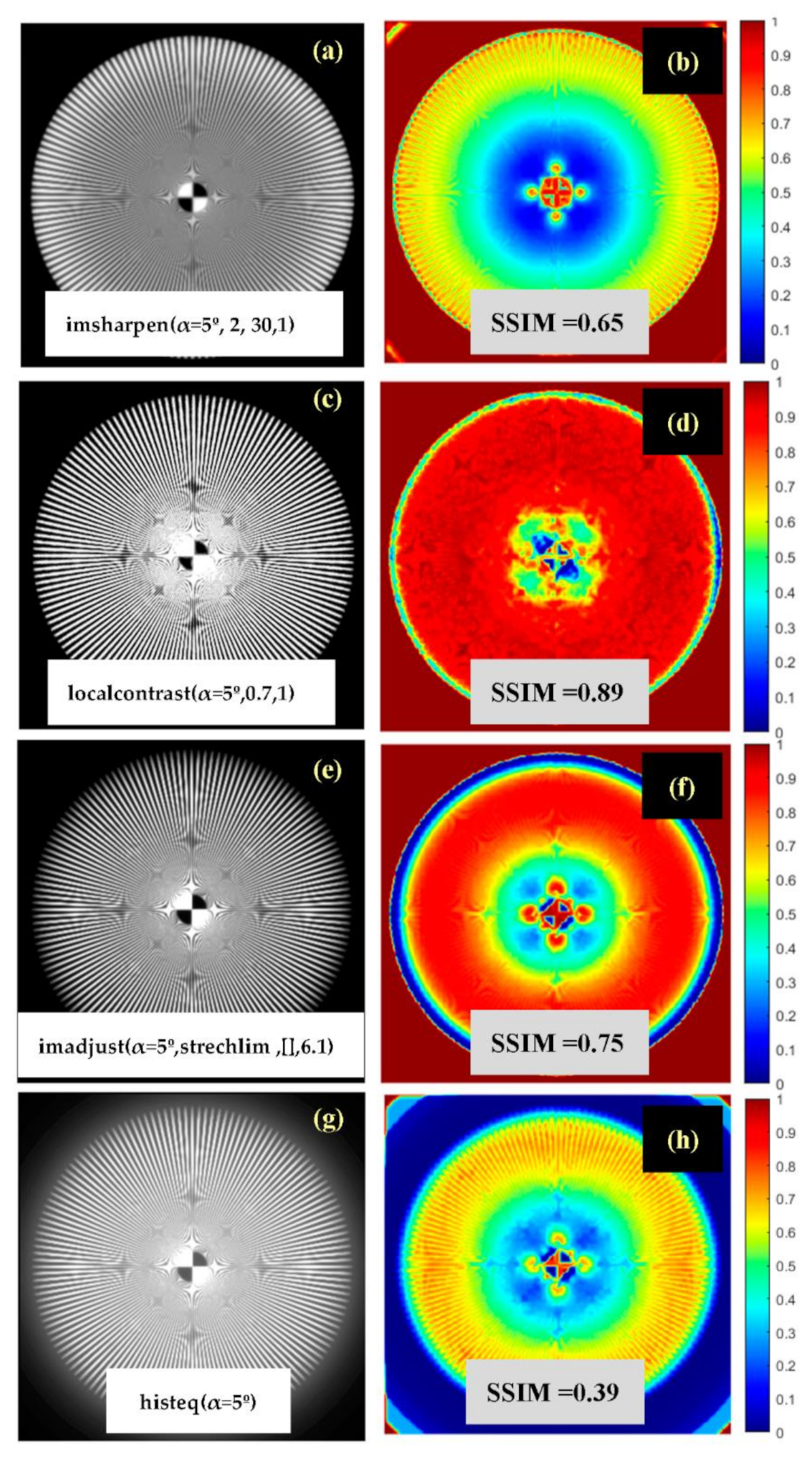 J Imaging Free Full Text Iterative Trained Semi Blind Deconvolution Algorithm To Compensate Straylight In Retinal Images Html