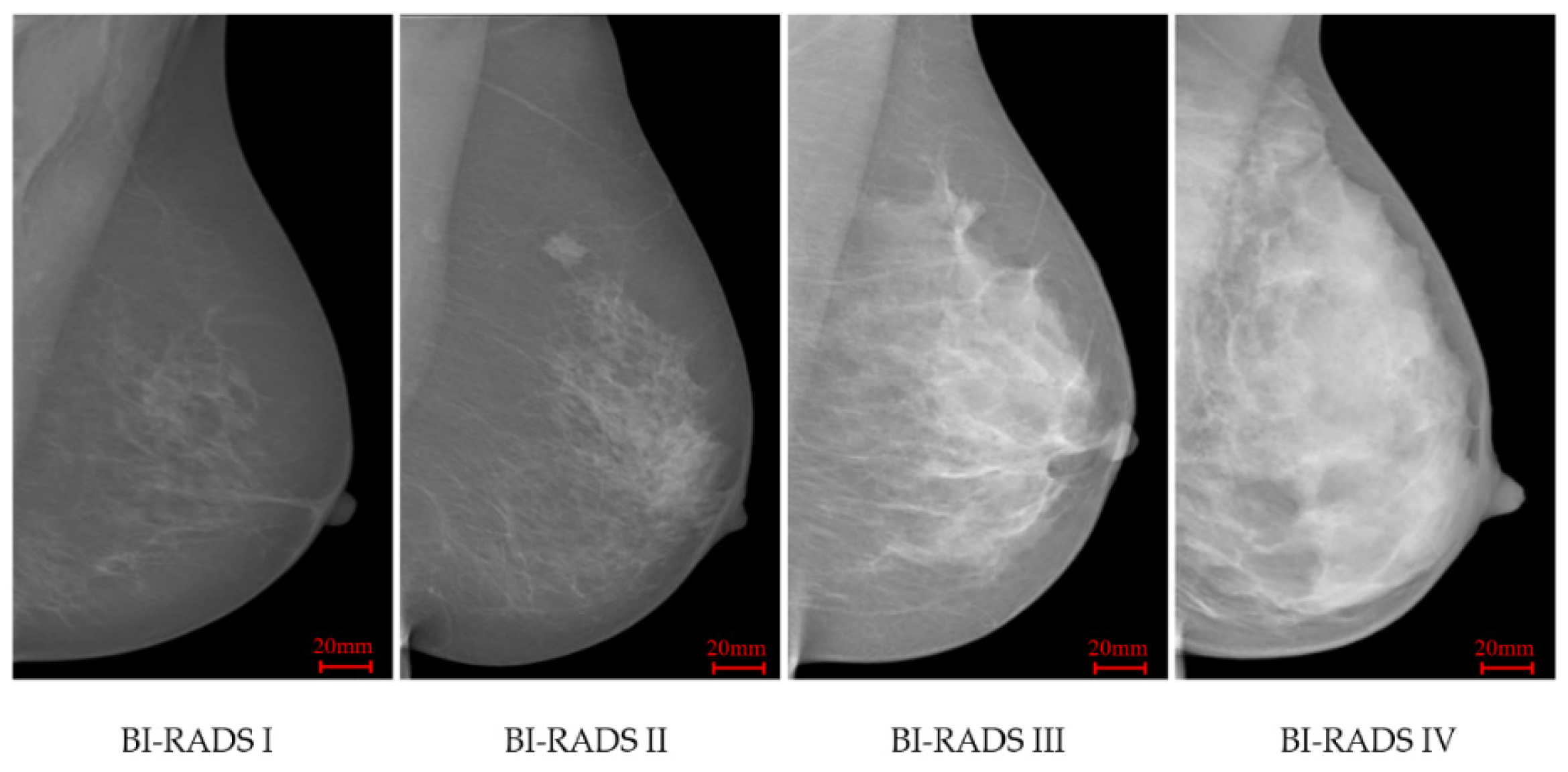 J. Imaging | Free Full-Text | Novel Texture Feature Descriptors Based on  Multi-Fractal Analysis and LBP for Classifying Breast Density in Mammograms