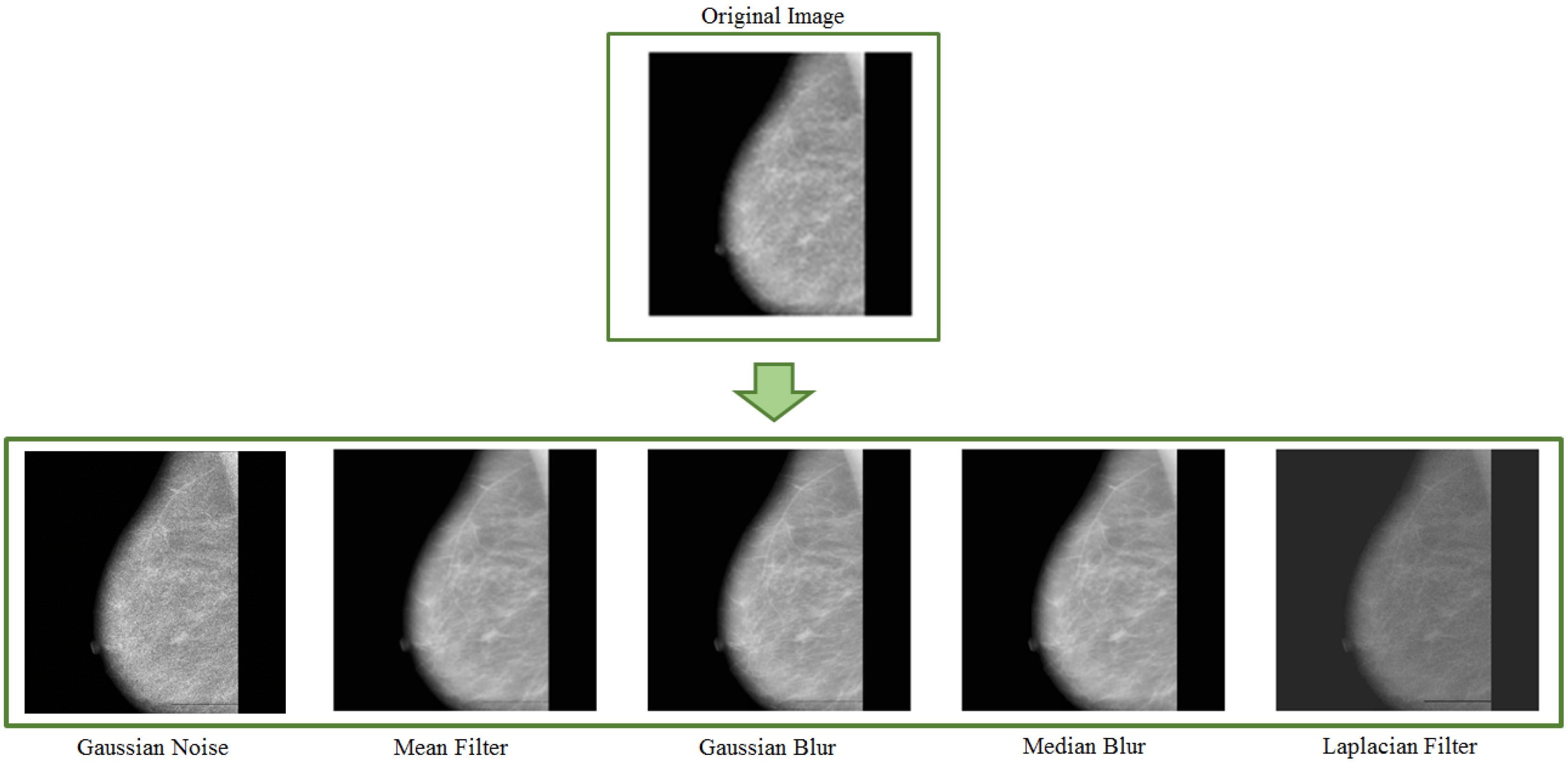 J. Imaging | Free Full-Text | Image Augmentation Techniques for Mammogram  Analysis