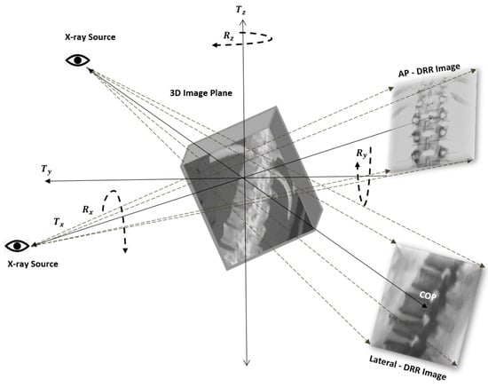 J. Imaging | Free Full-Text | A Hybrid 3D-2D Image Registration Framework  for Pedicle Screw Trajectory Registration between Intraoperative X-ray  Image and Preoperative CT Image | HTML