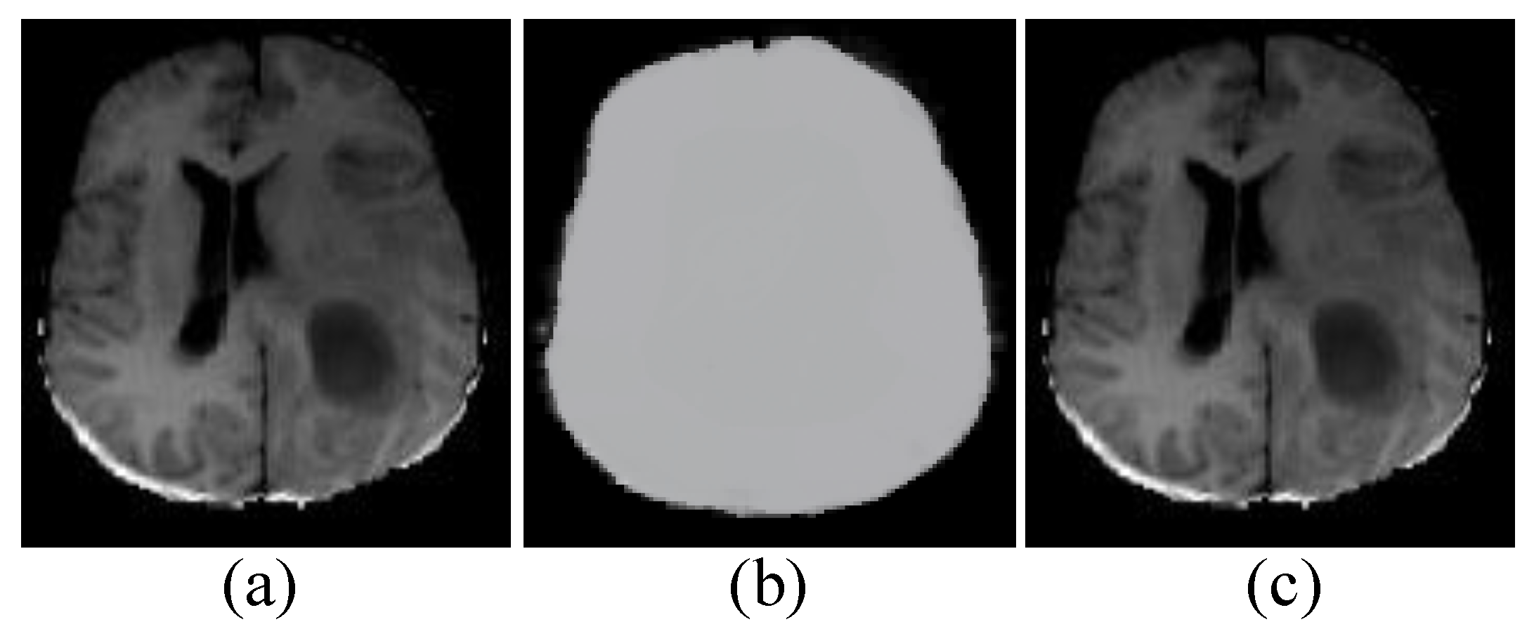 J. Imaging | Free Full-Text | Brain Tumor Segmentation Using Deep ...