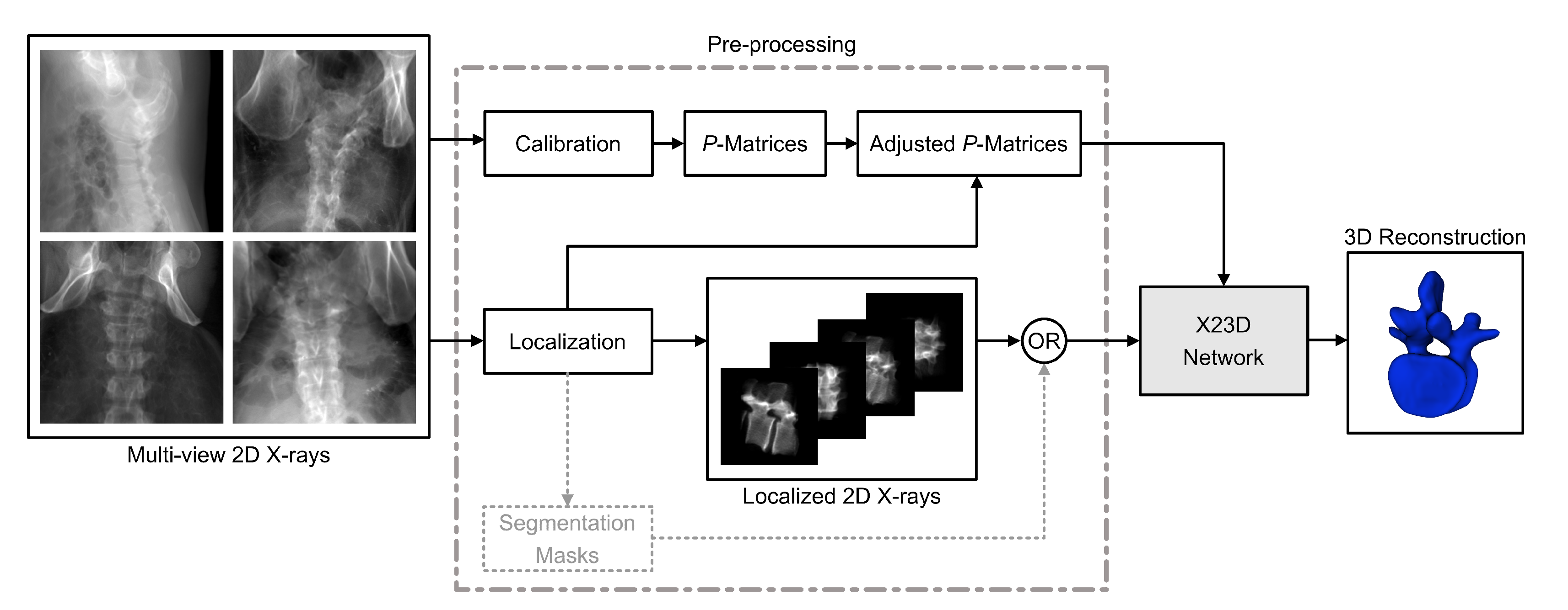 J. Imaging | Free Full-Text | X23D—Intraoperative 3D Lumbar ...