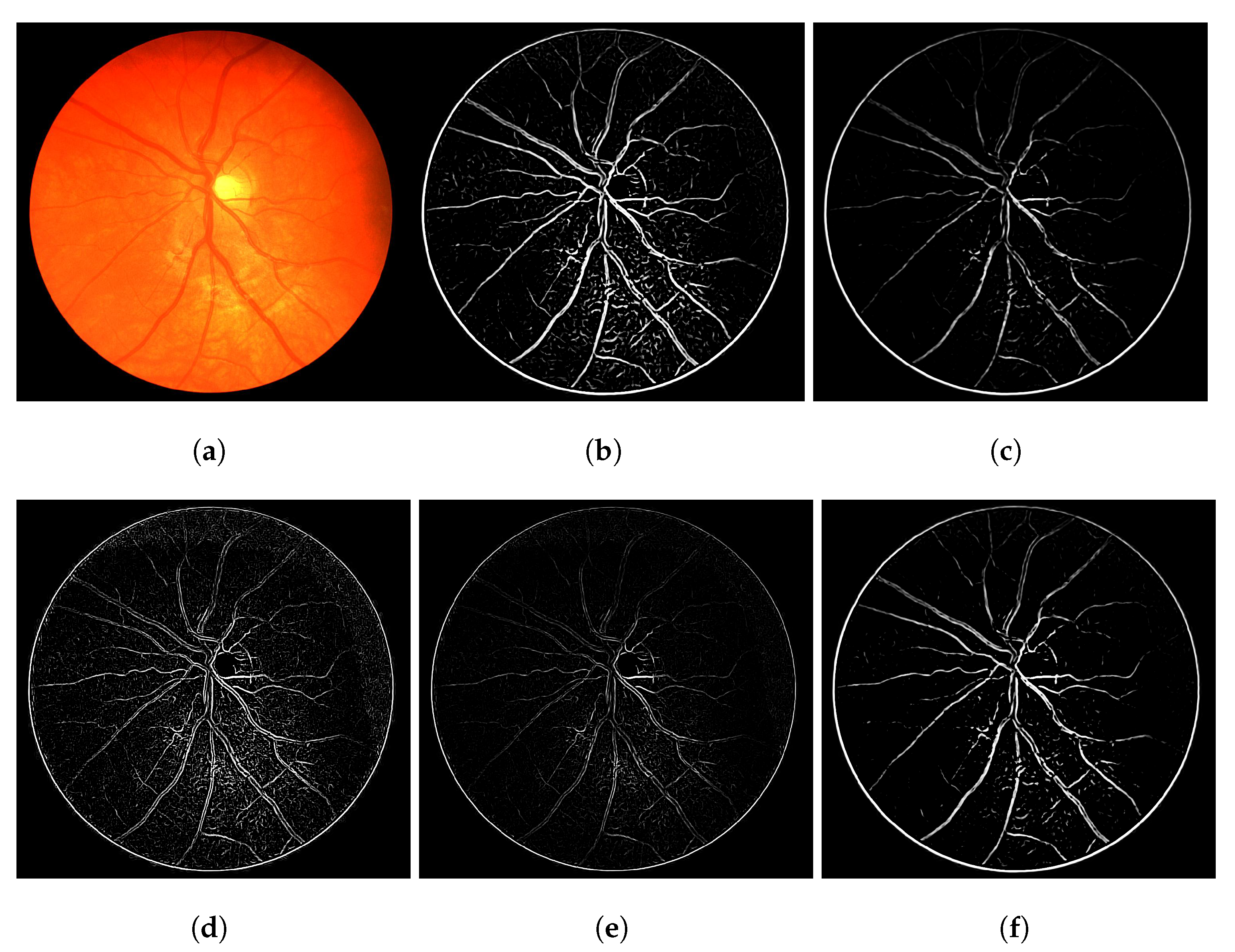 J. Imaging | Free Full-Text | Local-Sensitive Connectivity Filter (LS-CF):  A Post-Processing Unsupervised Improvement of the Frangi, Hessian and  Vesselness Filters for Multimodal Vessel Segmentation