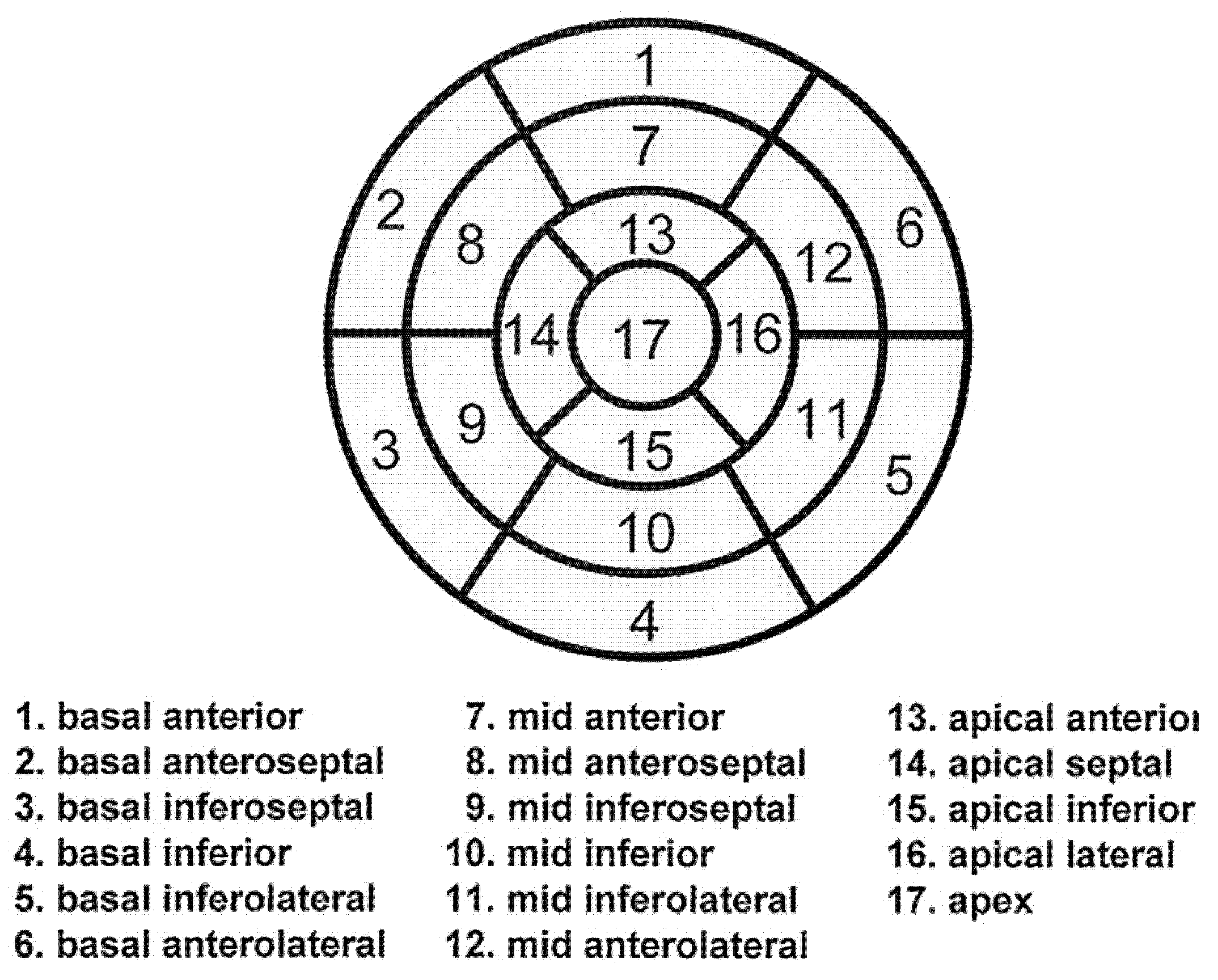 Локальная сократимость лж. 17 Сегментов левого желудочка. 16 Сегментарная модель левого желудочка. Схема бычий глаз ЭХОКГ. 17 Сегментная модель сердца.