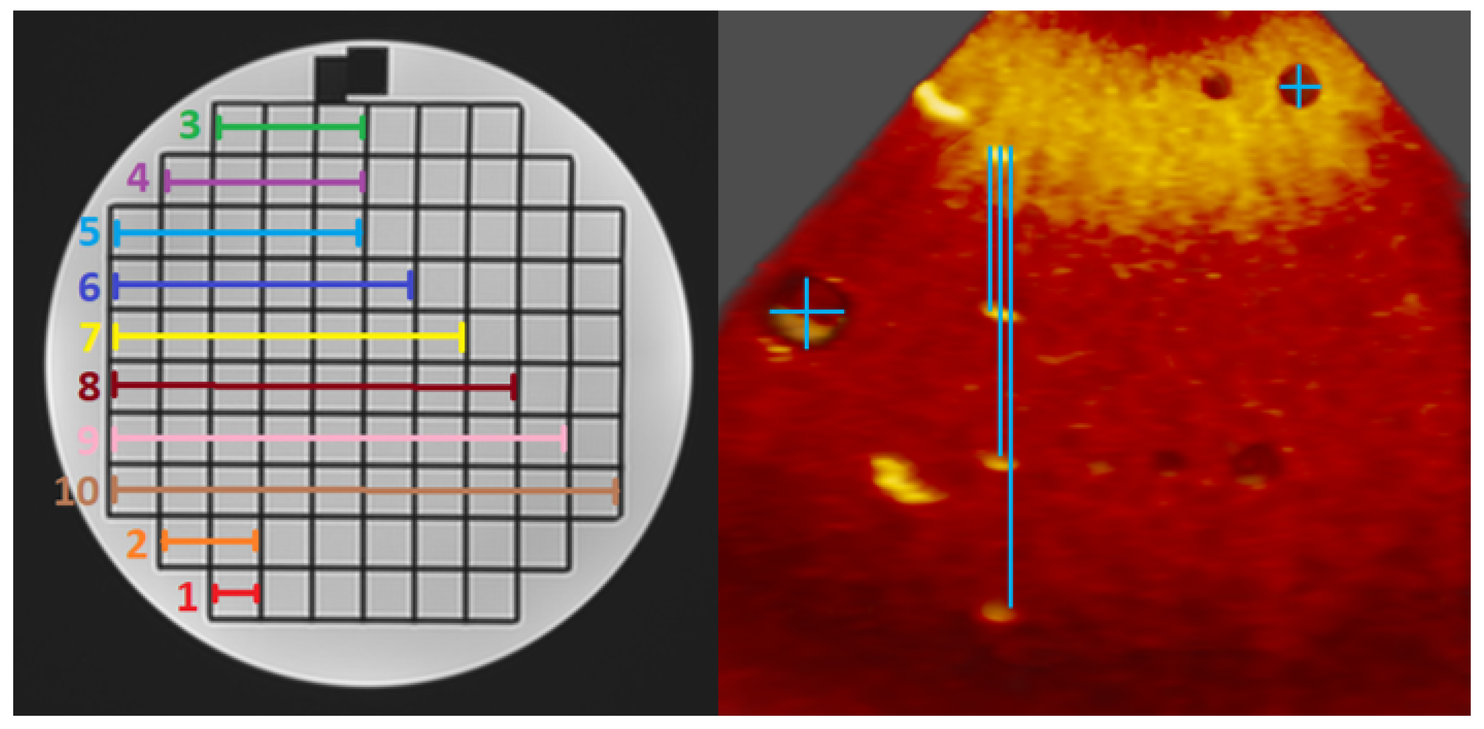 Jimaging 08 00304 g002 Jimaging 08 00304 g002