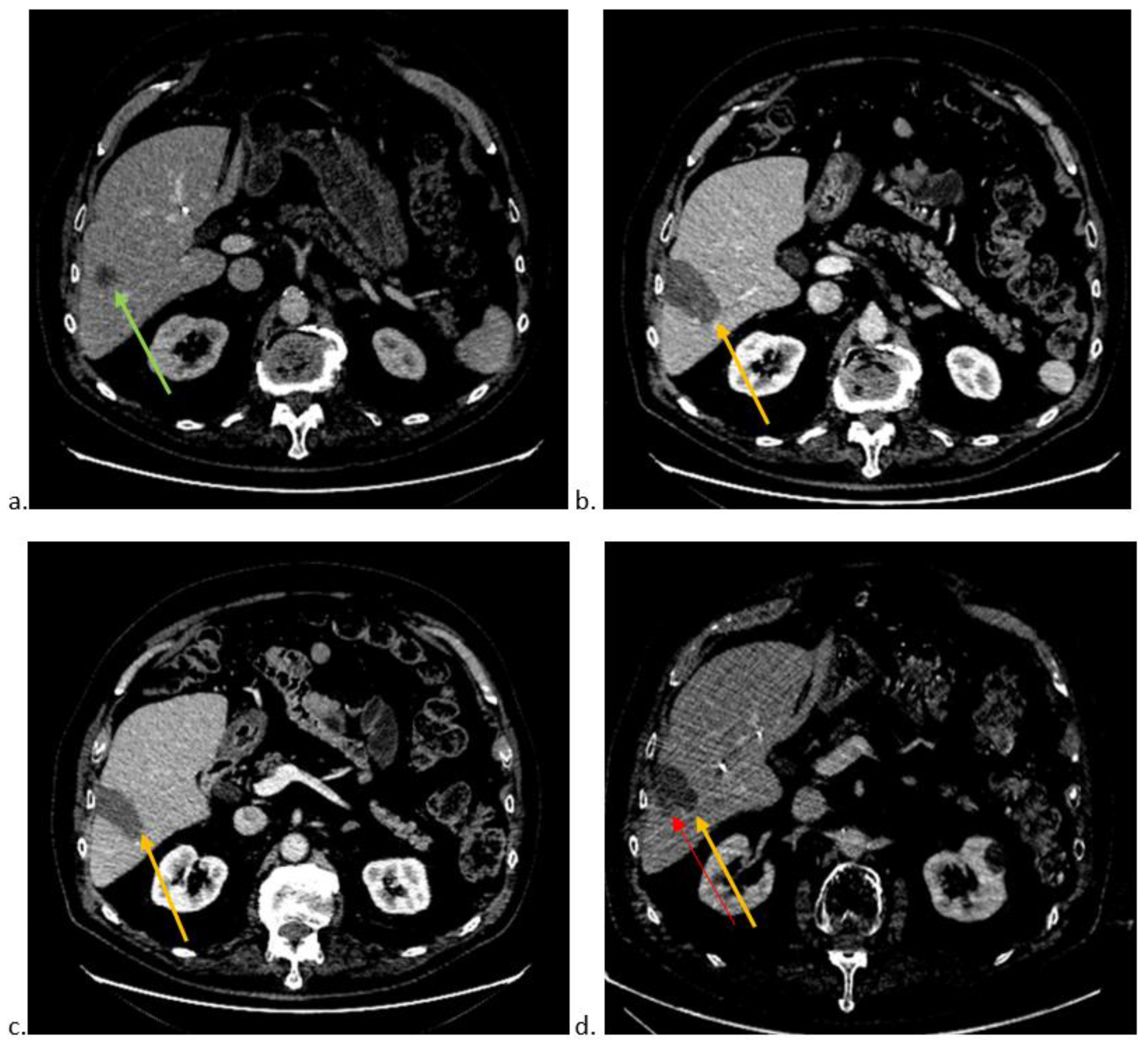 Jimaging 09 00066 g001 Jimaging 09 00066 g001