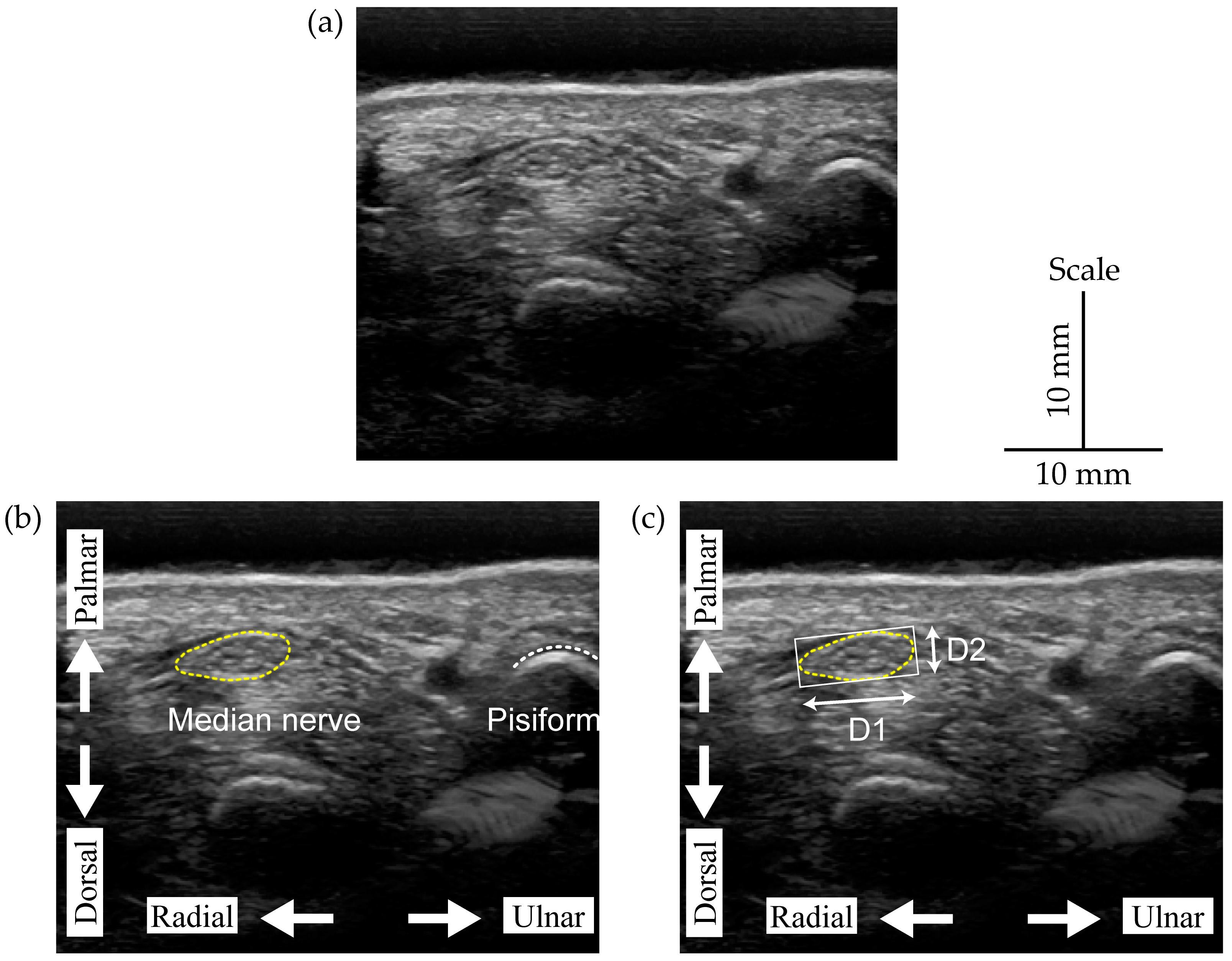 Jimaging 10 00013 g002 Jimaging 10 00013 g002