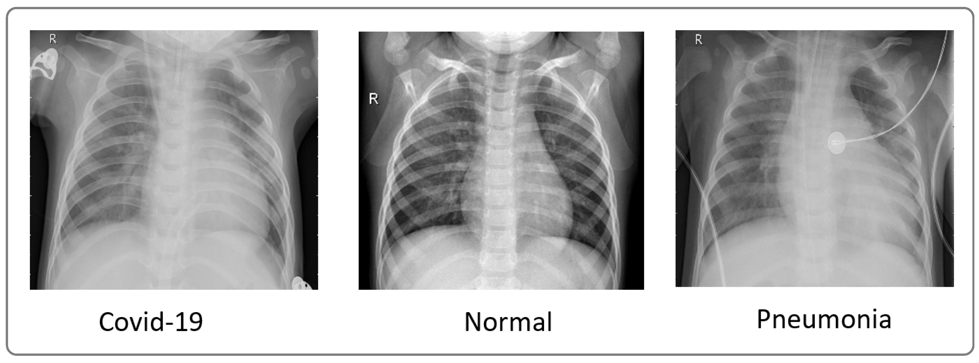 J. Imaging | Free Full-Text | Enhancing COVID-19 Detection: An Xception ...