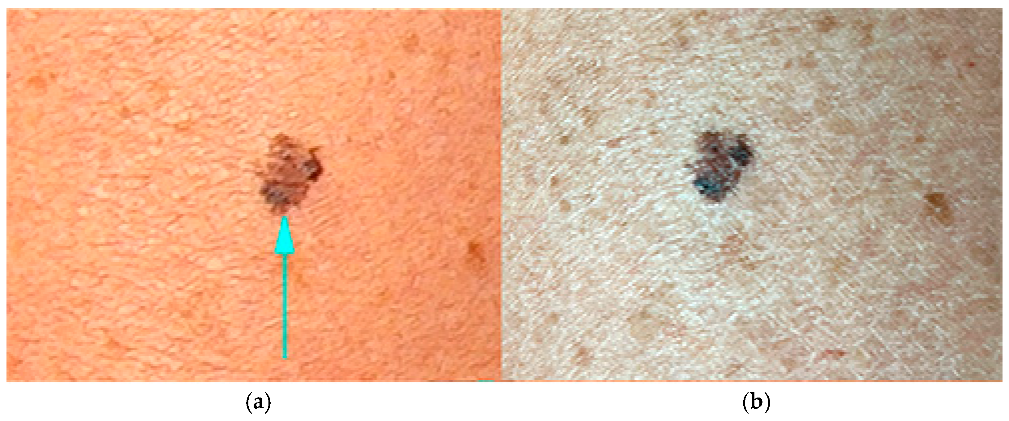 Jimaging 11 00107 g007 Jimaging 11 00107 g007