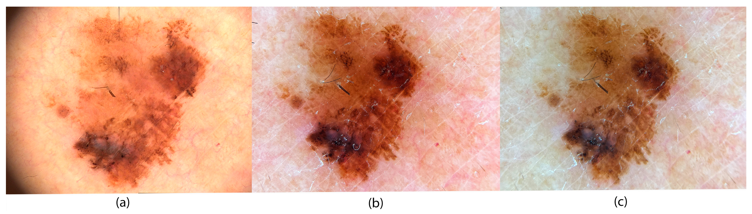 Jimaging 11 00107 g008 Jimaging 11 00107 g008