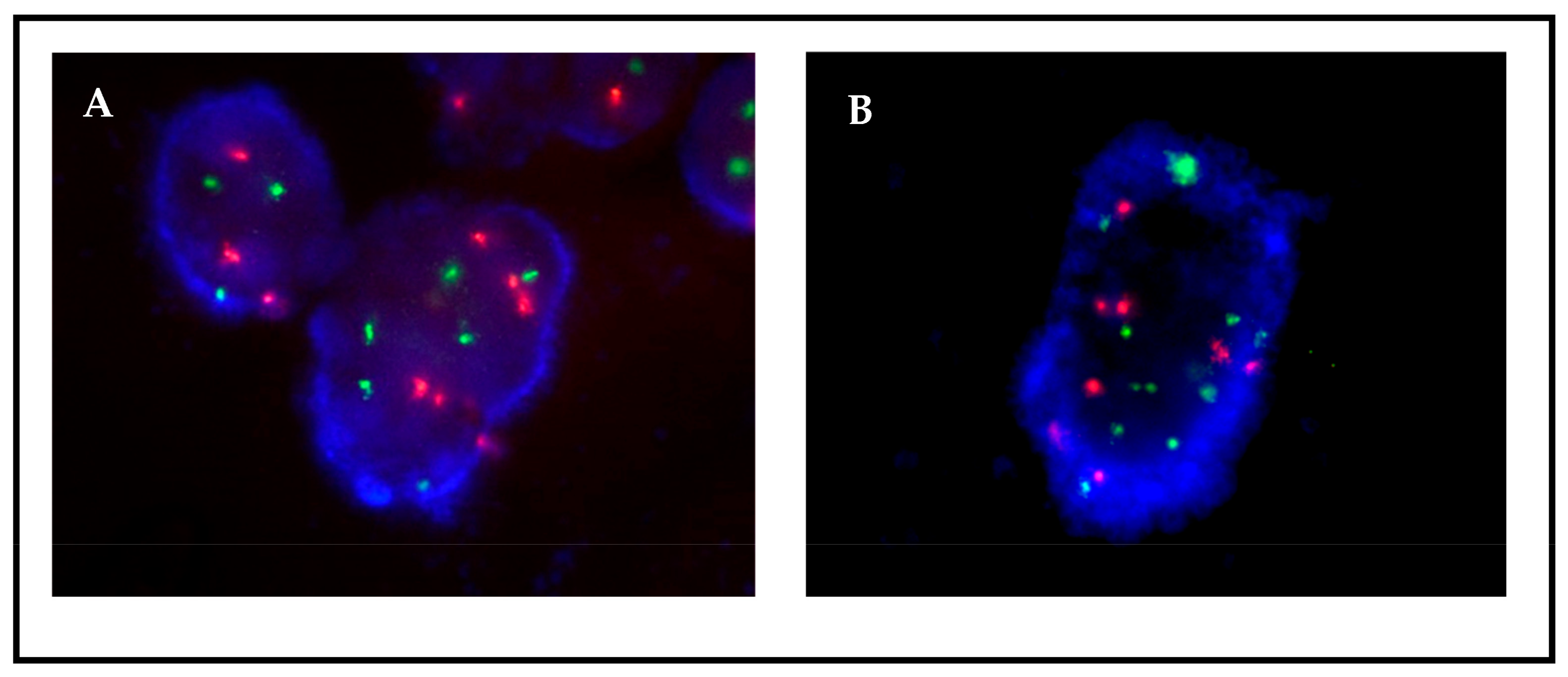 Jmp Free Full Text Fluorescence In Situ Hybridization Fish For