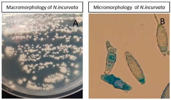 Tinea Capitis Caused by Microsporum audouinii: Lessons from a Swedish  Community Outbreak, HTML