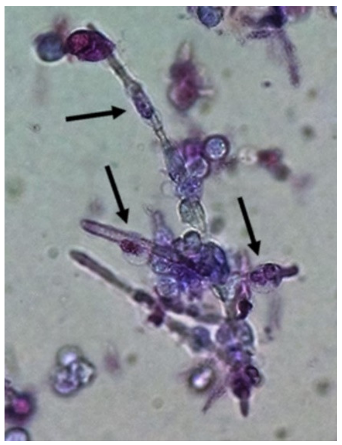 urine microscopy labeled