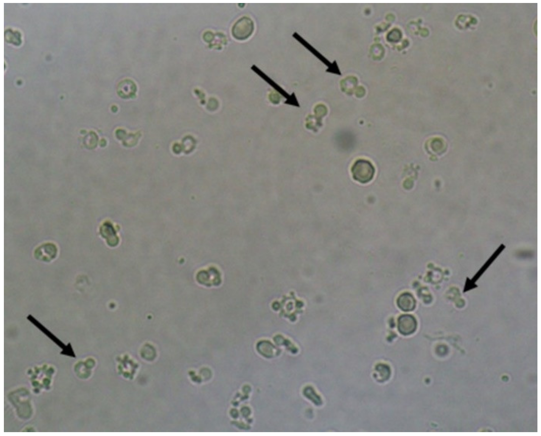 What Is Yeast Cells In Urine 8872