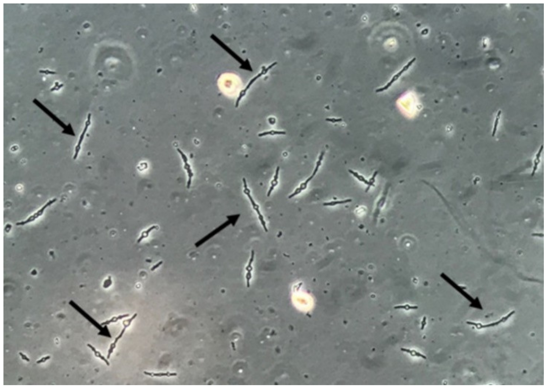 Bacteria In Urine Under Microscope 6676