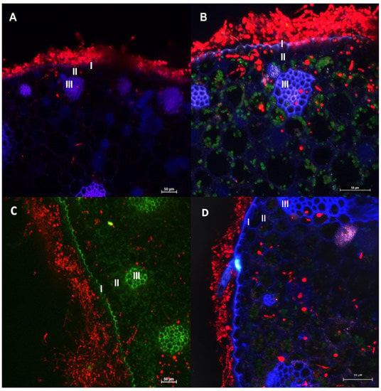 Jof Free Full Text Agrobacterium Tumefaciens Mediated Transformation Of Fonsecaea Monophora And Fonsecaea Erecta For Host Environment Interaction Studies Html