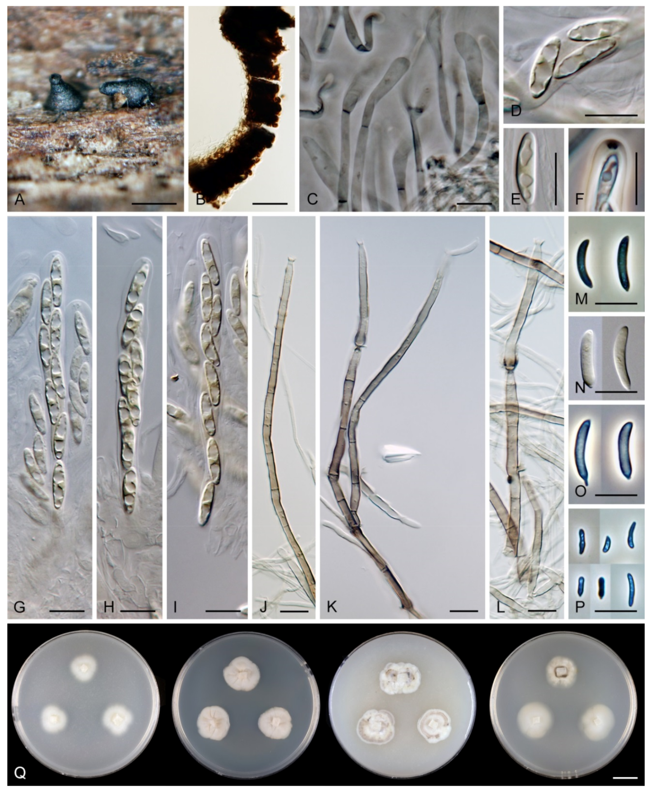 Jof Free Full Text Reflections On Menisporopsis Multiguttulispora And Tainosphaeria Using Molecular And Morphological Data Html