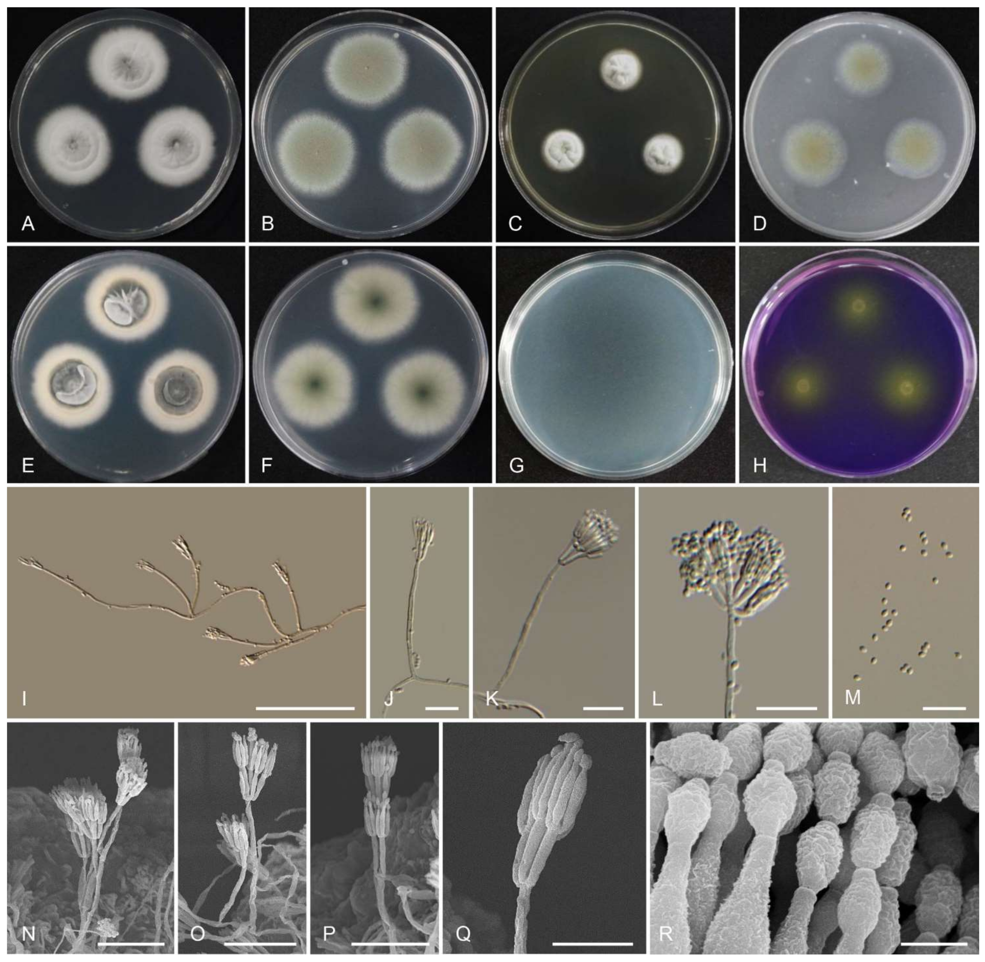 JoF | Free Full-Text | Discovery and Extrolite Production of Three New  Species of Talaromyces Belonging to Sections Helici and Purpurei from  Freshwater in Korea