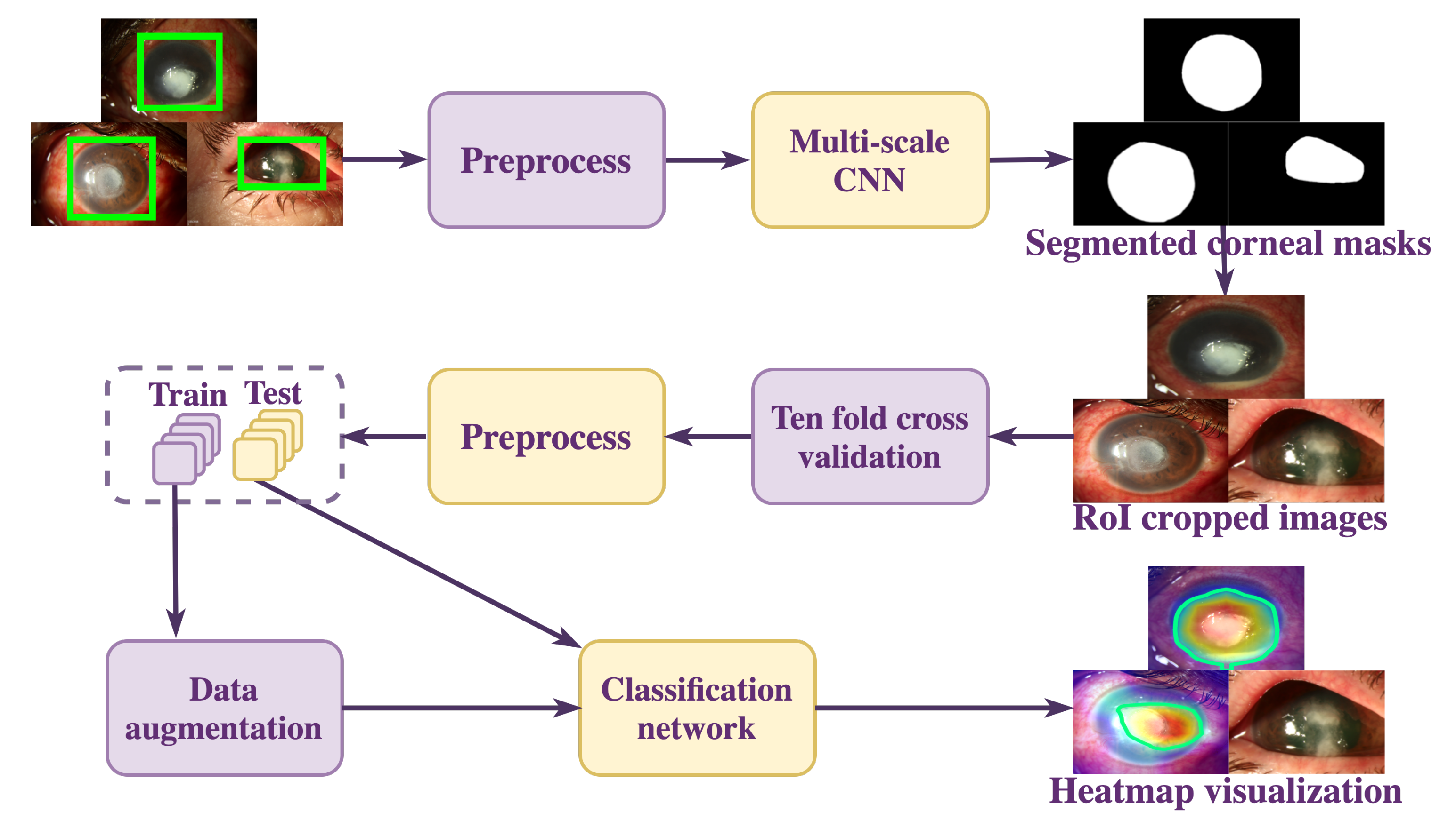 Jof Free Full Text Multi Scale Convolutional Neural Network For Accurate Corneal Segmentation In Early Detection Of Fungal Keratitis Html