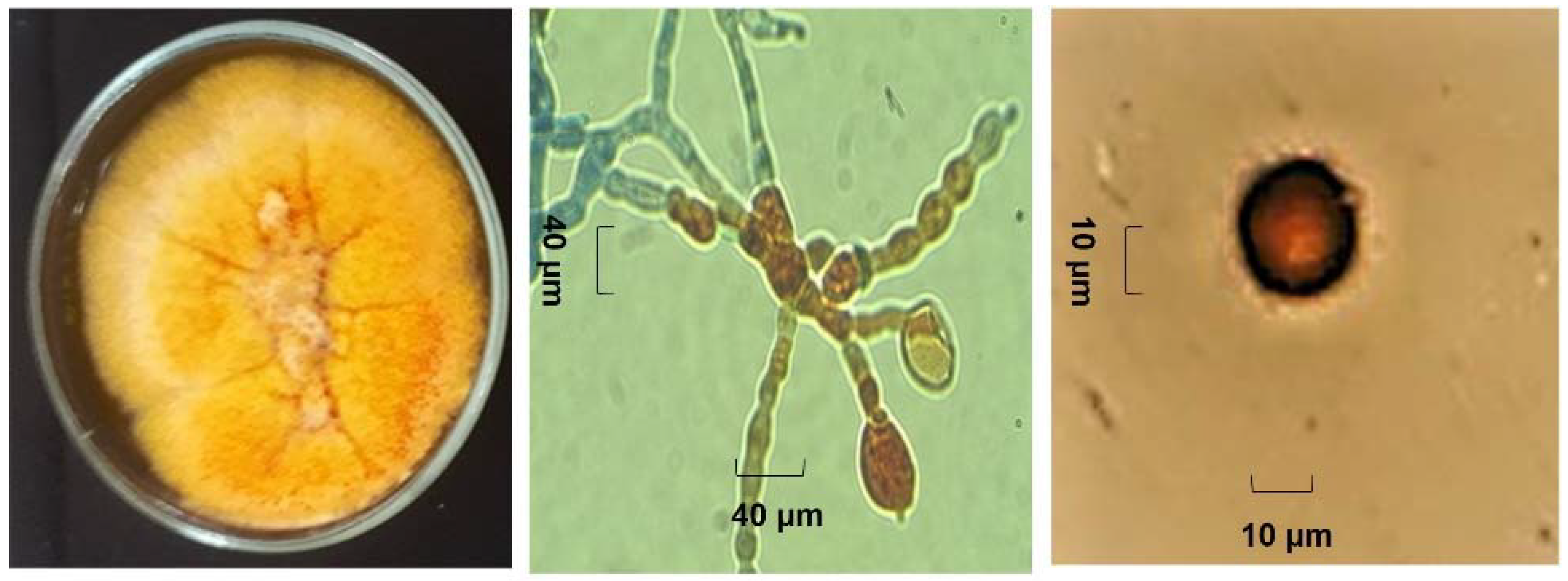 Jof 08 00197 g006 Jof 08 00197 g006