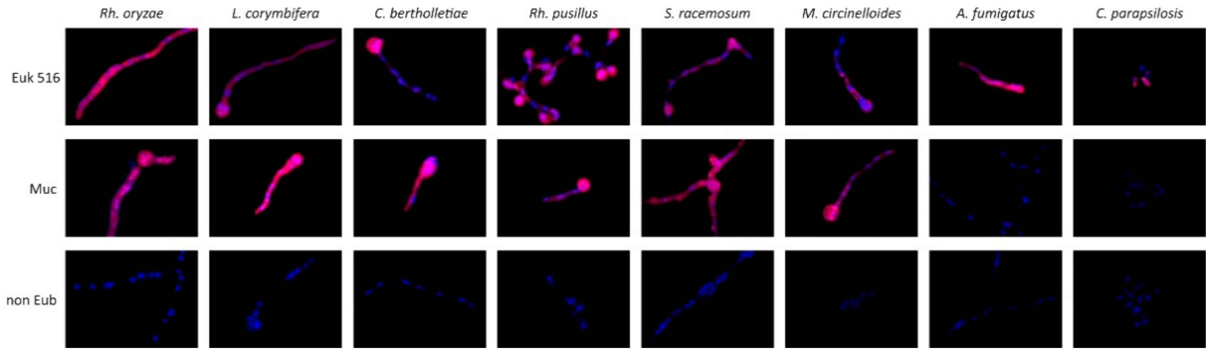 JoF | Free Full-Text | Identification of Mucormycosis by Fluorescence In  Situ Hybridization Targeting Ribosomal RNA in Tissue Samples