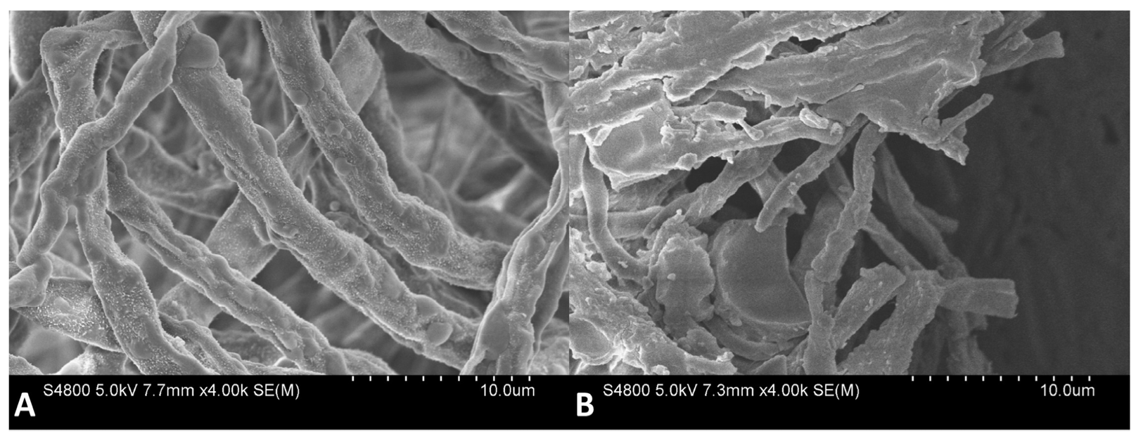 Jof 09 00005 g007 Jof 09 00005 g007