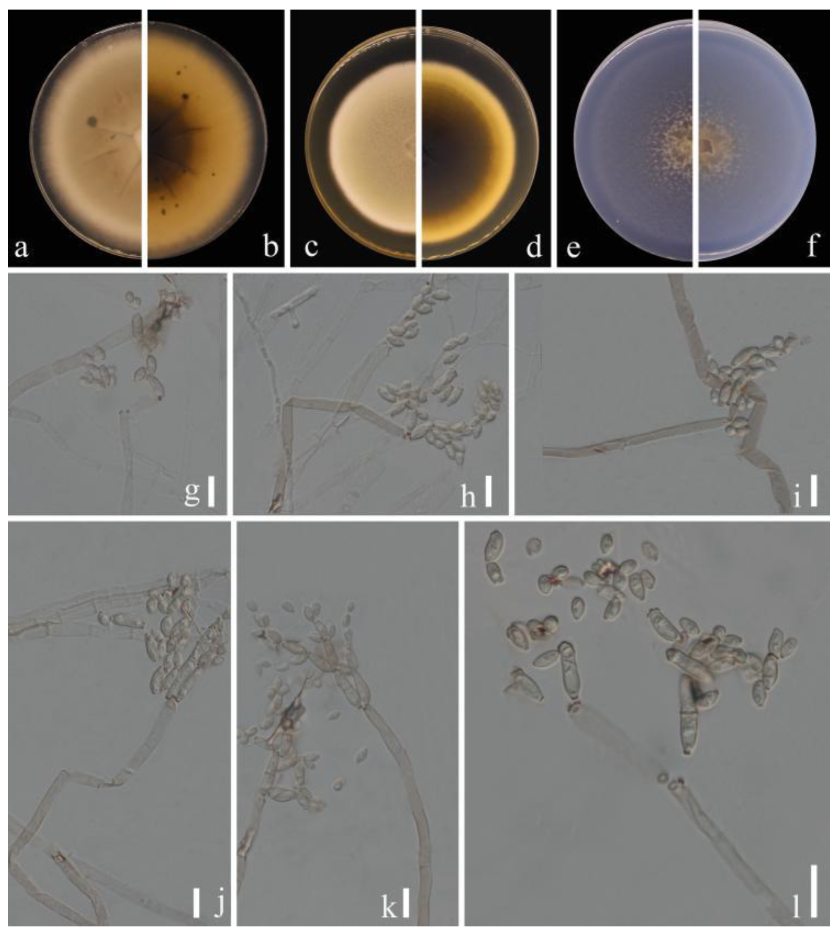 Jof 09 00250 g009 Jof 09 00250 g009